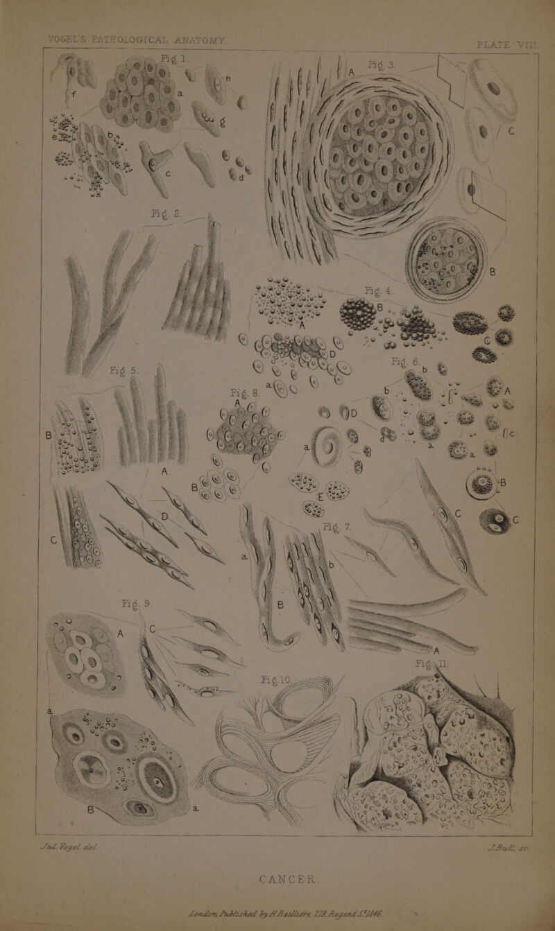 SEHE. ETE FAR Steins, ee . CRN CBB ee j 63 PRIPTT u : ae Lo, VOGEL'S PATHOLOGICAL ANATOMY. a,