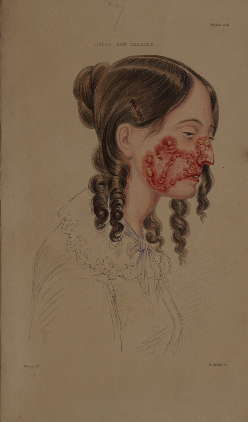 ; PIATE XI LUPUS NON EXEDENS. “Heyy