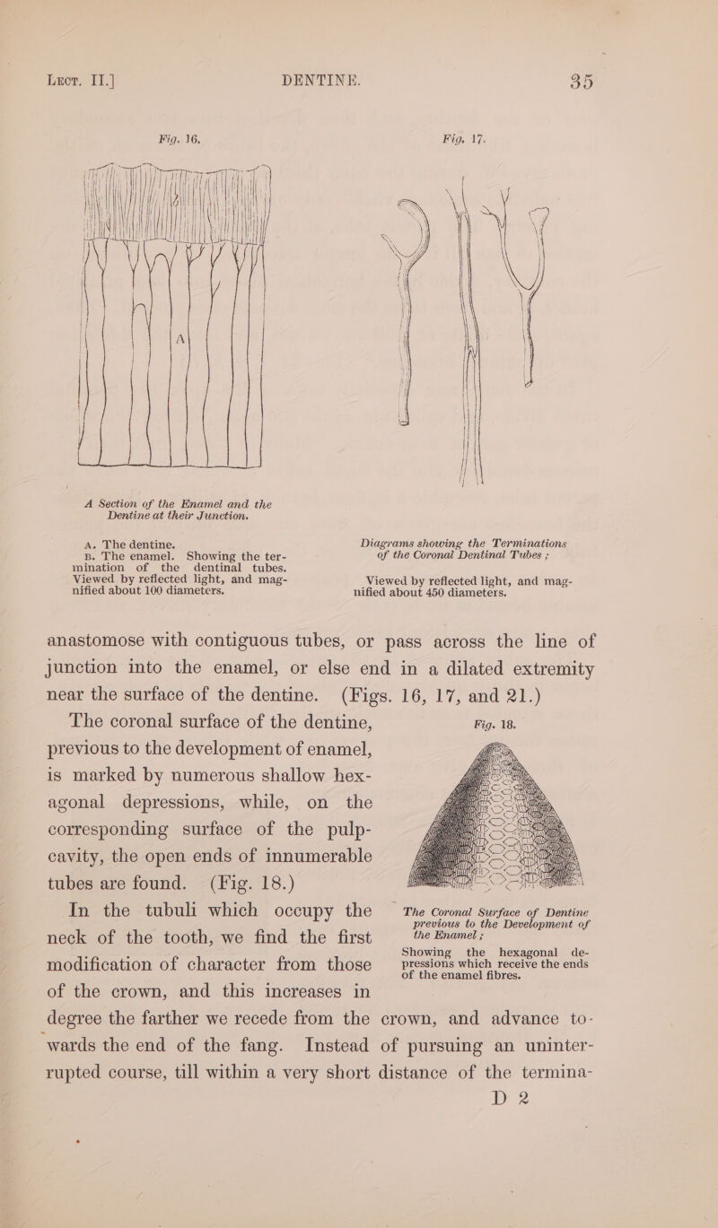 A Section of the Enamel and the Dentine at their Junction. A, The dentine. Diagrams showing the Terminations B. The enamel. Showing the ter- of the Coronal Dentinal Tubes ; mination of the dentinal tubes. Viewed by reflected light, and mag- Viewed by reflected light, and mag- nified about 100 diameters. nified about 450 diameters. anastomose with contiguous tubes, or pass across the line of junction into the enamel, or else end in a dilated extremity near the surface of the dentine. (Figs. 16, 17, and 21.) The coronal surface of the dentine, Fig. 18. previous to the development of enamel, is marked by numerous shallow hex- agonal depressions, while, on the corresponding surface of the pulp- cavity, the open ends of innumerable tubes are found. (Fig. 18.) In the tubuli which occupy the — The Coronat surface of Dentine previous to the Development of neck of the tooth, we find the first the Enamel ; 3 5 Showing the hexagonal de- modification of character from those __ pressions which receive the ends hae > of the enamel fibres. of the crown, and this increases in degree the farther we recede from the crown, and advance to- wards the end of the fang. Instead of pursuing an uninter- rupted course, till within a very short distance of the termina- D2