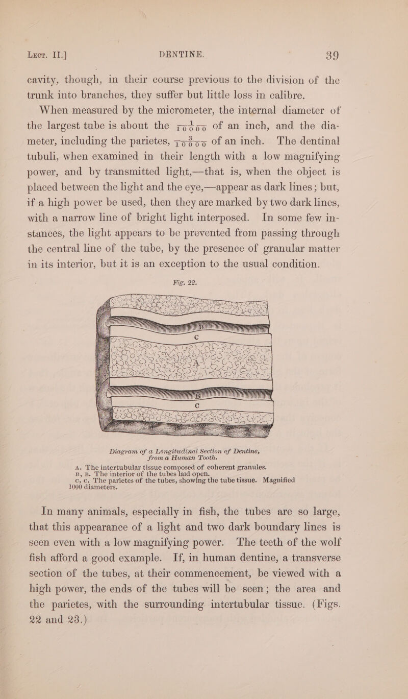 cavity, though, in their course previous to the division of the trunk into branches, they suffer but little loss in calibre. When measured by the micrometer, the internal diameter of the largest tube is about the ;o¢oo of an inch, and the dia- meter, including the parietes, 7>%55 of an inch. The dentinal tubuli, when examined in their length with a low magnifying power, and by transmitted light,—that is, when the object is placed between the light and the eye,—appear as dark lines; but, if a high power be used, then they are marked by two dark lines, with a narrow line of bright light interposed. In some few in- stances, the light appears to be prevented from passing through the central line of the tube, by the presence of granular matter in its interior, but it is an exception to the usual condition. ia ok > es Diagram of a Longitudinal Section of Dentine, from a Human Tooth. A. The intertubular tissue composed of coherent granules. B, B. The interior of the tubes laid open. . . c, c. The parietes of the tubes, showing the tube tissue. Magnified 1000 diameters. In many animals, especially in fish, the tubes are so large, that this appearance of a light and two dark boundary lines is seen even with a low magnifying power. The teeth of the wolf fish afford a good example. If, in human dentine, a transverse section of the tubes, at their commencement, be viewed with a high power, the ends of the tubes will be seen; the area and the parietes, with the surrounding intertubular tissue. (igs. 22 and 23.)