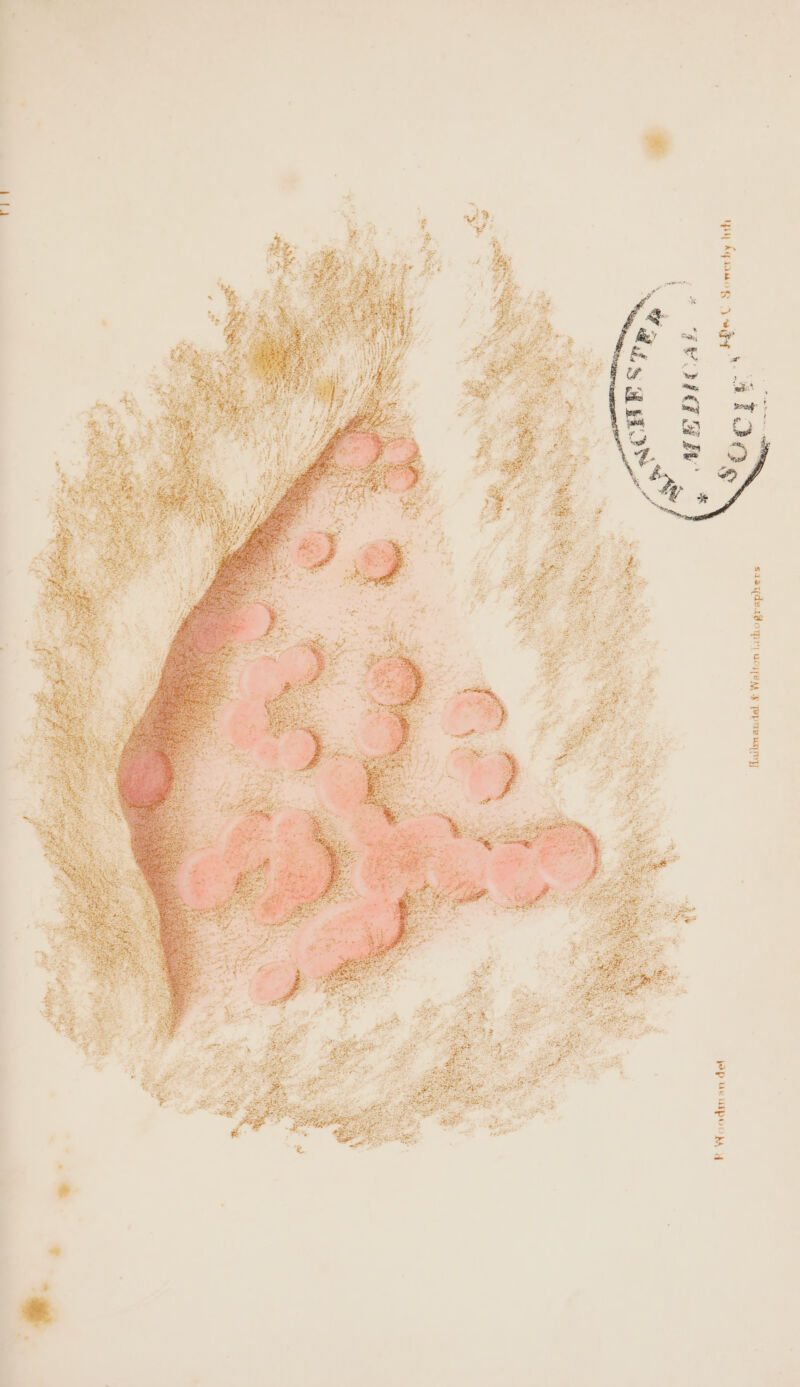 4 EP: — oe ” a MG GH vt PP UEUIPLCL AA y