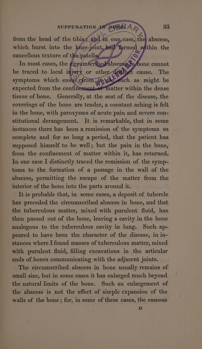 esatnfbone cannot cause. The ot ich as might be atter within the dense expected from the confirfeme tissue of bone. Generally, at the seat of the disease, the coverings of the bone are tender, a constant aching is felt in the bone, with paroxysms of acute pain and severe con- stitutional derangement. It is remarkable, that in some instances there has been a remission of the symptoms so complete and for so long a period, that the patient has supposed himself to be well; but the pain in the bone, from the confinement of matter within it, has returned. In one case I distinctly traced the remission of the symp- toms to the formation of a passage in the wall of the abscess, permitting the escape of the matter from the interior of the bone into the parts around it. It is probable that, in some cases, a deposit of tubercle has preceded the circumscribed abscess in bone, and that the tuberculous matter, mixed with purulent fluid, has. then passed out of the bone, leaving a cavity in the bone analogous to the tuberculous cavity in lung. Such ap- peared to have been the character of the disease, in in- stances where I found masses of tuberculous matter, mixed with purulent fluid, filling excavations in the articular ends of bones communicating with the adjacent joints. The circumscribed abscess in bone usually remains of small size, but in some cases it has enlarged much beyond the natural limits of the bone. Such an enlargement of the abscess is not the effect of simple expansion of the walls of the bone; for, in some of these cases, the osseous D