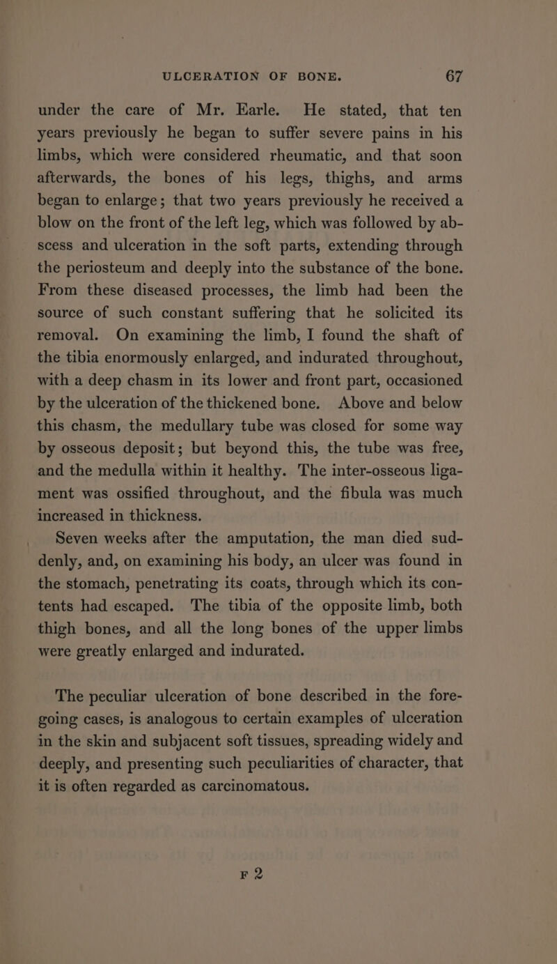 under the care of Mr. Earle. He stated, that ten years previously he began to suffer severe pains in his limbs, which were considered rheumatic, and that soon afterwards, the bones of his legs, thighs, and arms began to enlarge; that two years previously he received a blow on the front of the left leg, which was followed by ab- scess and ulceration in the soft parts, extending through the periosteum and deeply into the substance of the bone. From these diseased processes, the limb had been the source of such constant suffering that he solicited its removal. On examining the limb, I found the shaft of the tibia enormously enlarged, and indurated throughout, with a deep chasm in its lower and front part, occasioned by the ulceration of the thickened bone. Above and below this chasm, the medullary tube was closed for some way by osseous deposit; but beyond this, the tube was free, and the medulla within it healthy. The inter-osseous liga- ment was ossified throughout, and the fibula was much increased in thickness. Seven weeks after the amputation, the man died sud- denly, and, on examining his body, an ulcer was found in the stomach, penetrating its coats, through which its con- tents had escaped. The tibia of the opposite limb, both thigh bones, and all the long bones of the upper limbs were greatly enlarged and indurated. The peculiar ulceration of bone described in the fore- going cases, is analogous to certain examples of ulceration in the skin and subjacent soft tissues, spreading widely and deeply, and presenting such peculiarities of character, that it is often regarded as carcinomatous. F 2