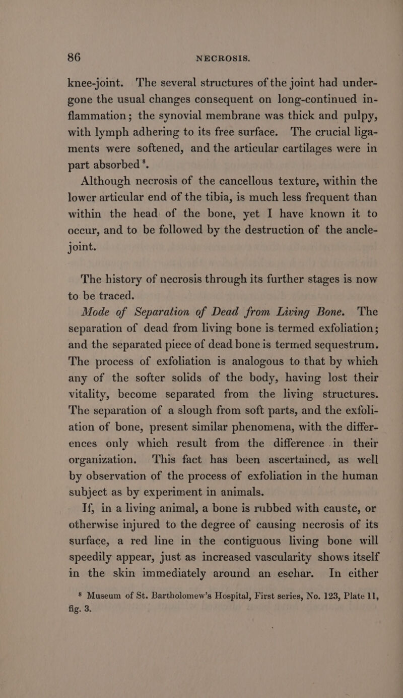 knee-joint. The several structures of the joint had under- gone the usual changes consequent on long-continued in- flammation; the synovial membrane was thick and pulpy, with lymph adhering to its free surface. The crucial liga- ments were softened, and the articular cartilages were in part absorbed °. Although necrosis of the cancellous texture, within the lower articular end of the tibia, is much less frequent than within the head of the bone, yet I have known it to occur, and to be followed by the destruction of the ancle- joint. The history of necrosis through its further stages is now to be traced. Mode of Separation of Dead from Living Bone. The separation of dead from living bone is termed exfoliation; and the separated piece of dead bone is termed sequestrum. The process of exfoliation is analogous to that by which any of the softer solids of the body, having lost their vitality, become separated from the living structures. The separation of a slough from soft parts, and the exfoli- ation of bone, present similar phenomena, with the differ- ences only which result from the difference in their organization. This fact has been ascertained, as well by observation of the process of exfoliation in the human subject as by experiment in animals. If, in a living animal, a bone is rubbed with caustc, or otherwise injured to the degree of causing necrosis of its surface, a red line in the contiguous living bone will speedily appear, just as increased vascularity shows itself in the skin immediately around an eschar. In either 8 Museum of St. Bartholomew’s Hospital, First series, No. 123, Plate 11, fig. 3.
