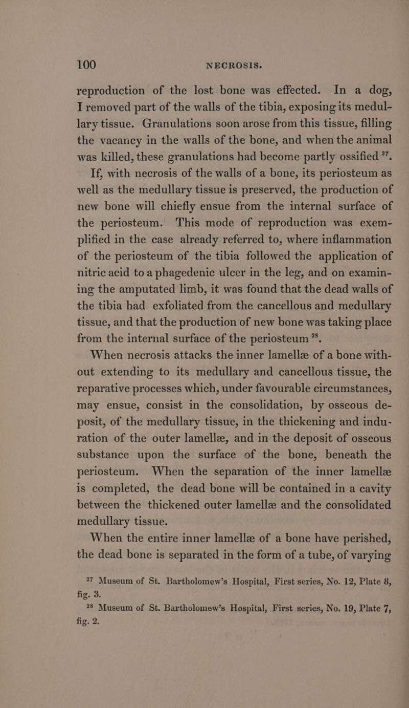 reproduction of the lost bone was effected. In a dog, I removed part of the walls of the tibia, exposing its medul- lary tissue. Granulations soon arose from this tissue, filling the vacaricy in the walls of the bone, and when the animal was killed, these granulations had become partly ossified *’. If, with necrosis of the walls of a bone, its periosteum as well as the medullary tissue is preserved, the production of new bone will chiefly ensue from the internal surface of the periosteum. This mode of reproduction was exem- plified in the case already referred to, where inflammation of the periosteum of the tibia followed the application of nitric acid to a phagedenic ulcer in the leg, and on examin- ing the amputated limb, it was found that the dead walls of the tibia had exfoliated from the cancellous and medullary tissue, and that the production of new bone was taking place from the internal surface of the periosteum ™. When necrosis attacks the inner lamellz of a bone with- out extending to its medullary and cancellous tissue, the reparative processes which, under favourable circumstances, may ensue, consist in the consolidation, by osseous de- posit, of the medullary tissue, in the thickening and indu- ration of the outer lamellz, and in the deposit of osseous substance upon the surface of the bone, beneath the periosteum. When the separation of the inner lamelle is completed, the dead bone will be contained in a cavity between the thickened outer lamelle and the consolidated medullary tissue. When the entire inner lamellz of a bone have perished, the dead bone is separated in the form of a tube, of varying 27 Museum of St. Bartholomew’s Hospital, First series, No. 12, Plate 8, fig. 3. 28 Museum of St. Bartholomew’s Hospital, First series, No. 19, Plate 7, fig. 2.