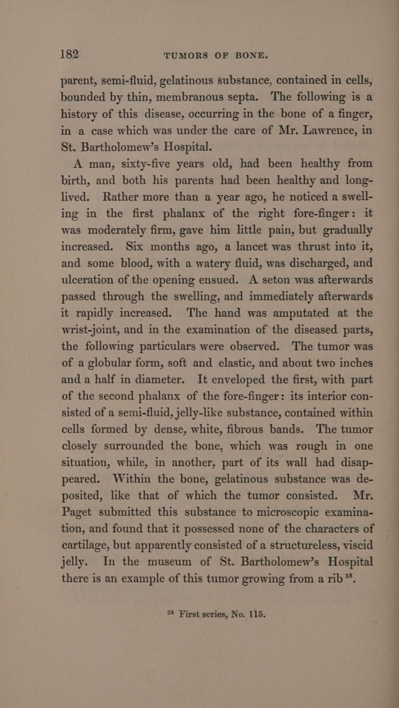 parent, semi-fluid, gelatinous substance, contained in cells, bounded by thin, membranous septa. The following is a history of this disease, occurring in the bone of a finger, in a case which was under the care of Mr. Lawrence, in St. Bartholomew’s Hospital. A man, sixty-five years old, had been healthy from birth, and both his parents had been healthy and long- lived. Rather more than a year ago, he noticed a swell- ing in the first phalanx of the right fore-finger: it was moderately firm, gave him little pain, but gradually increased. Six months ago, a lancet was thrust into it, and some blood, with a watery fluid, was discharged, and ulceration of the opening ensued. A seton was afterwards passed through the swelling, and immediately afterwards it rapidly increased. The hand was amputated at the wrist-joint, and in the examination of the diseased parts, the following particulars were observed. The tumor was of a globular form, soft and elastic, and about two inches and a half in diameter. It enveloped the first, with part of the second phalanx of the fore-finger: its interior con- sisted of a semi-fluid, jelly-like substance, contained within cells formed by dense, white, fibrous bands. The tumor closely surrounded the bone, which was rough in one situation, while, in another, part of its wall had disap- peared. Within the bone, gelatinous substance was de- posited, like that of which the tumor consisted. Mr. Paget submitted this substance to microscopic examina- tion, and found that it possessed none of the characters of cartilage, but apparently consisted of a structureless, viscid jelly. In the museum of St. Bartholomew’s Hospital there is an example of this tumor growing from a rib*®. 38 First series, No. 115.