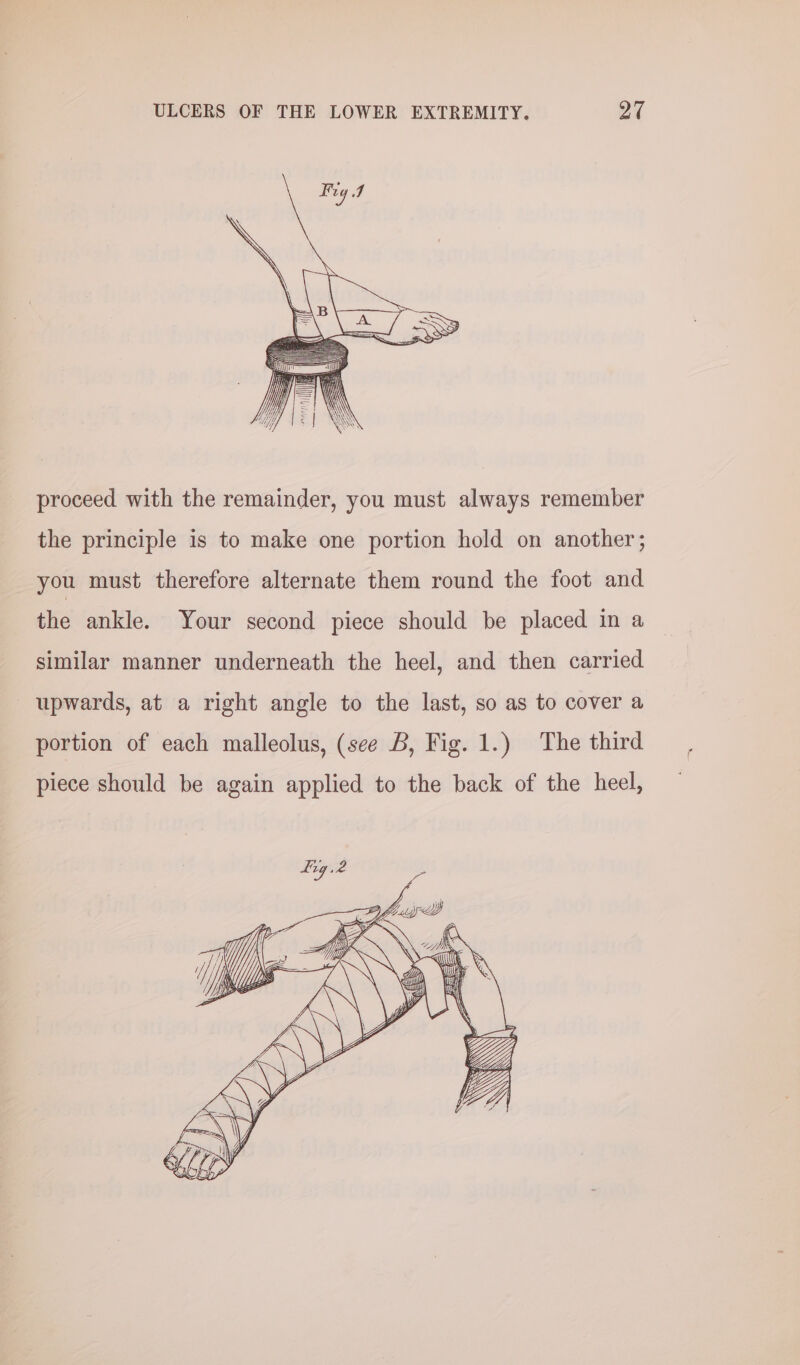 proceed with the remainder, you must always remember the principle is to make one portion hold on another; you must therefore alternate them round the foot and the ankle. Your second piece should be placed in a similar manner underneath the heel, and then carried upwards, at a right angle to the last, so as to cover a portion of each malleolus, (see b, Fig. 1.) The third piece should be again applied to the back of the heel,