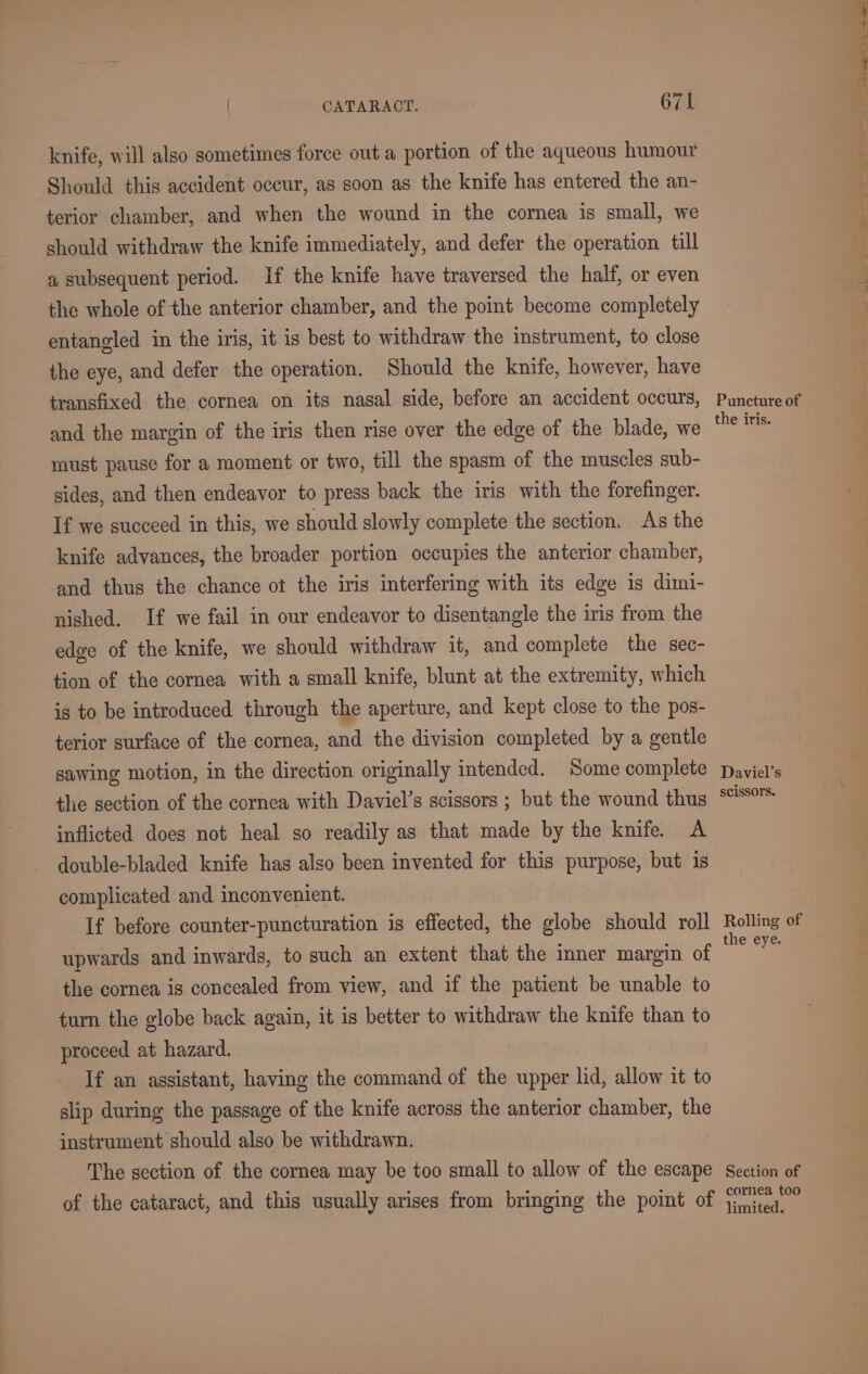 knife, will also sometimes force out a portion of the aqueous humour Should this accident occur, as soon as the knife has entered the an- terior chamber, and when the wound in the cornea is small, we should withdraw the knife immediately, and defer the operation till a subsequent period. If the knife have traversed the half, or even the whole of the anterior chamber, and the point become completely entangled in the iris, it is best to withdraw the instrument, to close the eye, and defer the operation. Should the knife, however, have transfixed the cornea on its nasal side, before an accident occurs, and the margin of the iris then rise over the edge of the blade, we must pause for a moment or two, till the spasm of the muscles sub- sides, and then endeavor to press back the iris with the forefinger. If we succeed in this, we should slowly complete the section. As the knife advances, the broader portion occupies the anterior chamber, and thus the chance ot the iris interfering with its edge is dimi- nished. If we fail in our endeavor to disentangle the iris from the edge of the knife, we should withdraw it, and complete the sec- tion of the cornea with a small knife, blunt at the extremity, which is to be introduced through the aperture, and kept close to the pos- terior surface of the cornea, and the division completed by a gentle sawing motion, in the direction originally intended. Some complete the section of the cornea with Daviel’s scissors ; but the wound thus inflicted does not heal so readily as that made by the knife. A double-bladed knife has also been invented for this purpose, but is complicated and inconvenient. If before counter-puncturation is effected, the globe should roll upwards and inwards, to such an extent that the inner margin of the cornea is concealed from view, and if the patient be unable to turn the globe back again, it is better to withdraw the knife than to proceed at hazard. If an assistant, having the command of the upper lid, allow it to slip during the passage of the knife across the anterior chamber, the instrument should also be withdrawn. The section of the cornea may be too small to allow of the escape of the cataract, and this usually arises from bringing the point of Puncture of the iris. Daviel’s SCISSOTS. e eye. Section of cornea too limited. Oe ee
