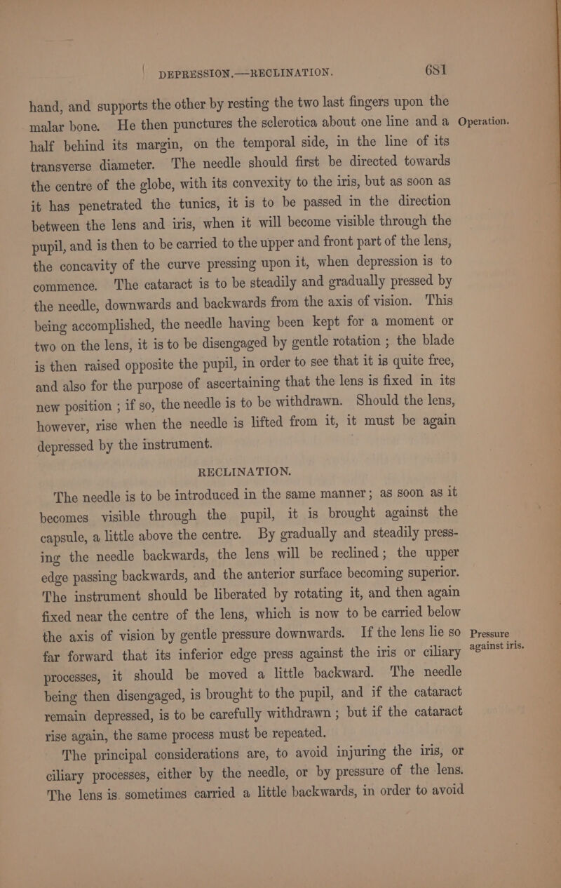 hand, and supports the other by resting the two last fingers upon the malar bone. He then punctures the sclerotica about one line and a half behind its margin, on the temporal side, in the line of its transverse diameter. The needle should first be directed towards the centre of the globe, with its convexity to the iris, but as soon as it has penetrated the tunics, it is to be passed in the direction between the lens and iris, when it will become visible through the pupil, and is then to be carried to the upper and front part of the lens, the concavity of the curve pressing upon it, when depression is to commence. The cataract is to be steadily and gradually pressed by the needle, downwards and backwards from the axis of vision. ‘T'his being accomplished, the needle having been kept for a moment or two on the lens, it is to be disengaged by gentle rotation ; the blade is then raised opposite the pupil, in order to see that it is quite free, and also for the purpose of ascertaining that the lens is fixed in its new position ; if so, the needle is to be withdrawn. Should the lens, however, rise when the needle is lifted from it, it must be again depressed by the instrument. RECLINATION. The needle is to be introduced in the same manner; as soon as it becomes visible through the pupil, it is brought against the capsule, a little above the centre. By gradually and steadily press- ing the needle backwards, the lens will be reclined ; the upper edge passing backwards, and the anterior surface becoming superior. The instrument should be liberated by rotating it, and then again fixed near the centre of the lens, which is now to be carried below the axis of vision by gentle pressure downwards. If the lens lie so far forward that its inferior edge press against the iris or ciliary processes, it should be moved a little backward. The needle being then disengaged, is brought to the pupil, and if the cataract remain depressed, is to be carefully withdrawn ; but if the cataract rise again, the same process must be repeated. The principal considerations are, to avoid injuring the iris, or ciliary processes, either by the needle, or by pressure of the lens. The lens ig. sometimes carried a little backwards, in order to avoid Operation. Pressure against iris.