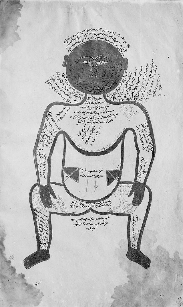 No text description is available for this image