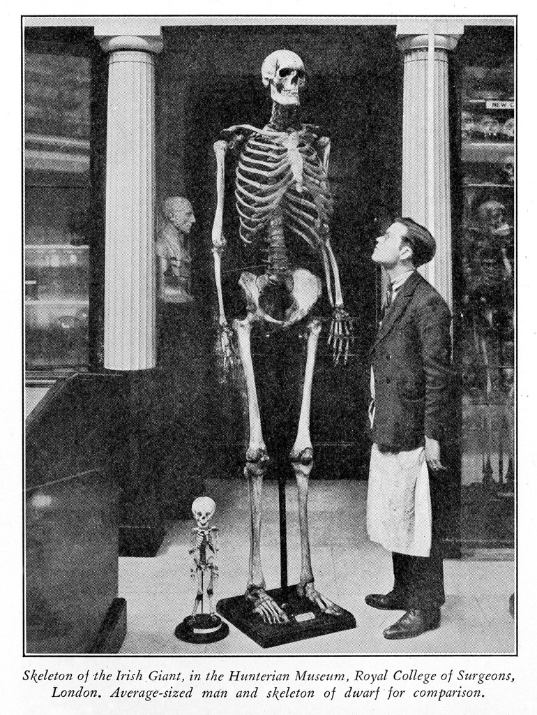 M0003815: Skeleton of Charles Byrne, known as "the Irish Giant" | Wellcome  Collection