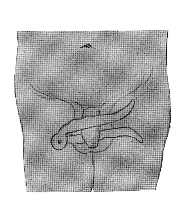 No text description is available for this image