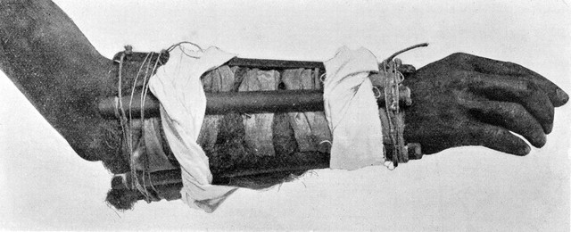 No text description is available for this image