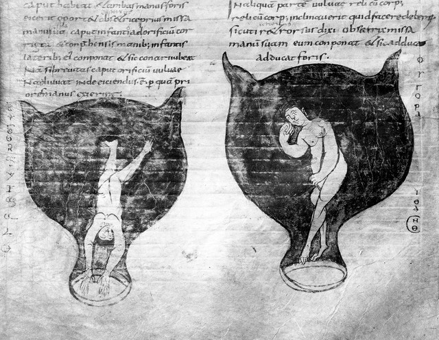 No text description is available for this image