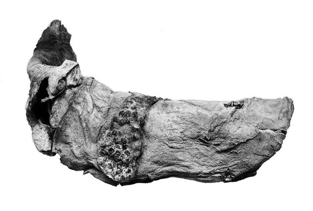 No text description is available for this image