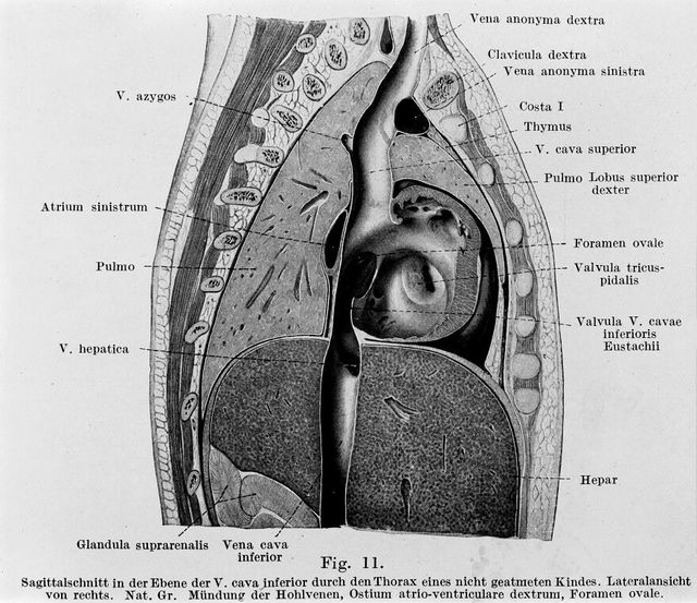 digitised image 1