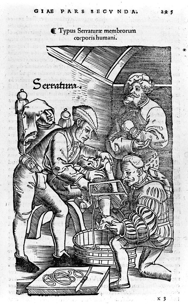 No text description is available for this image