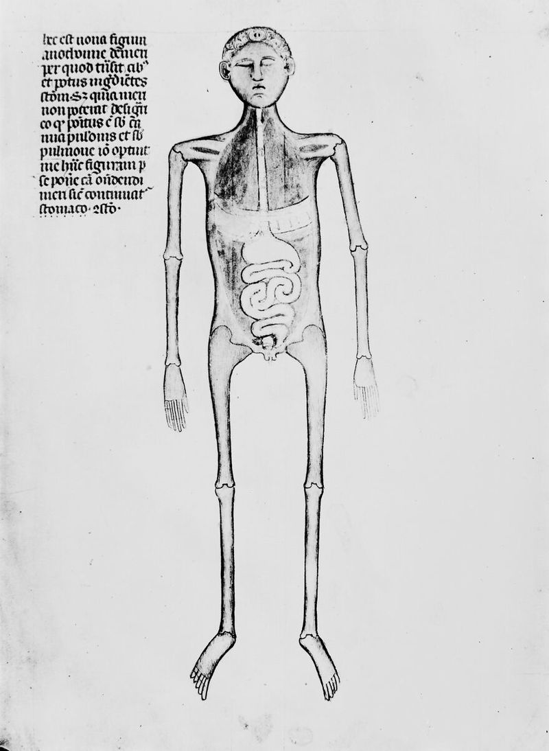 No text description is available for this image