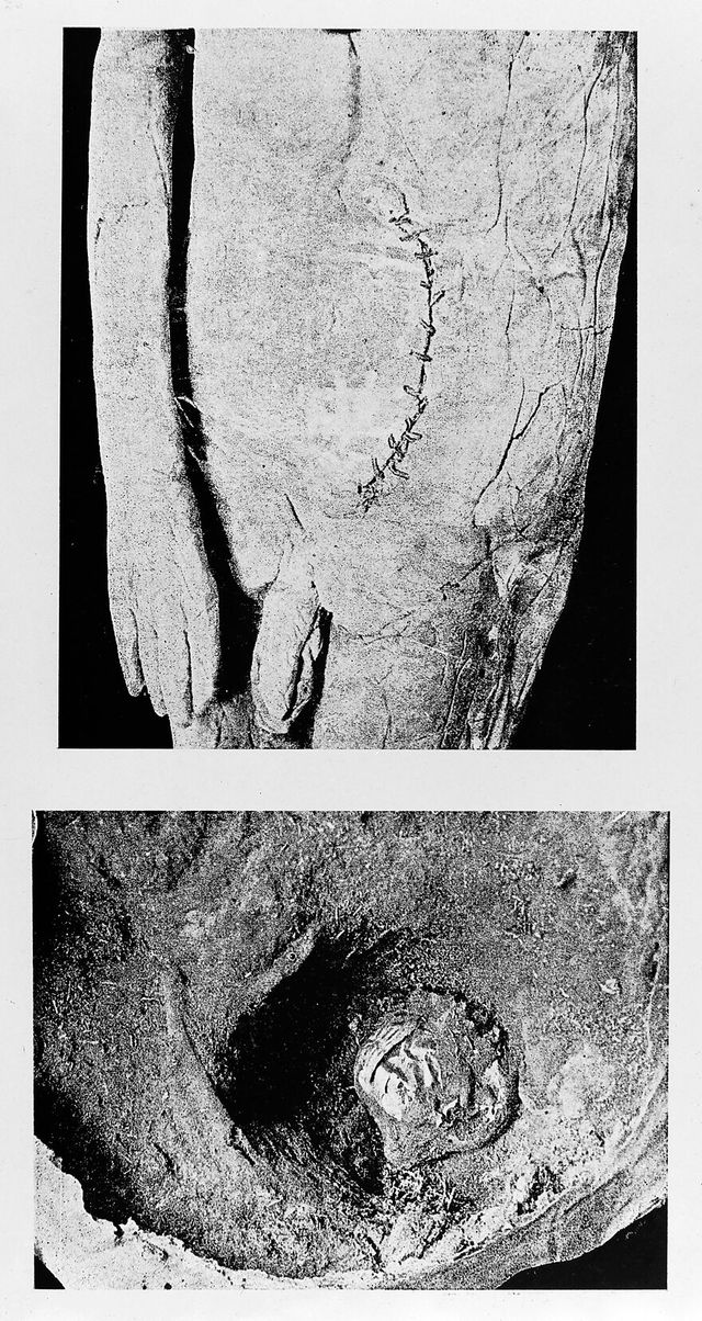 digitised image 1