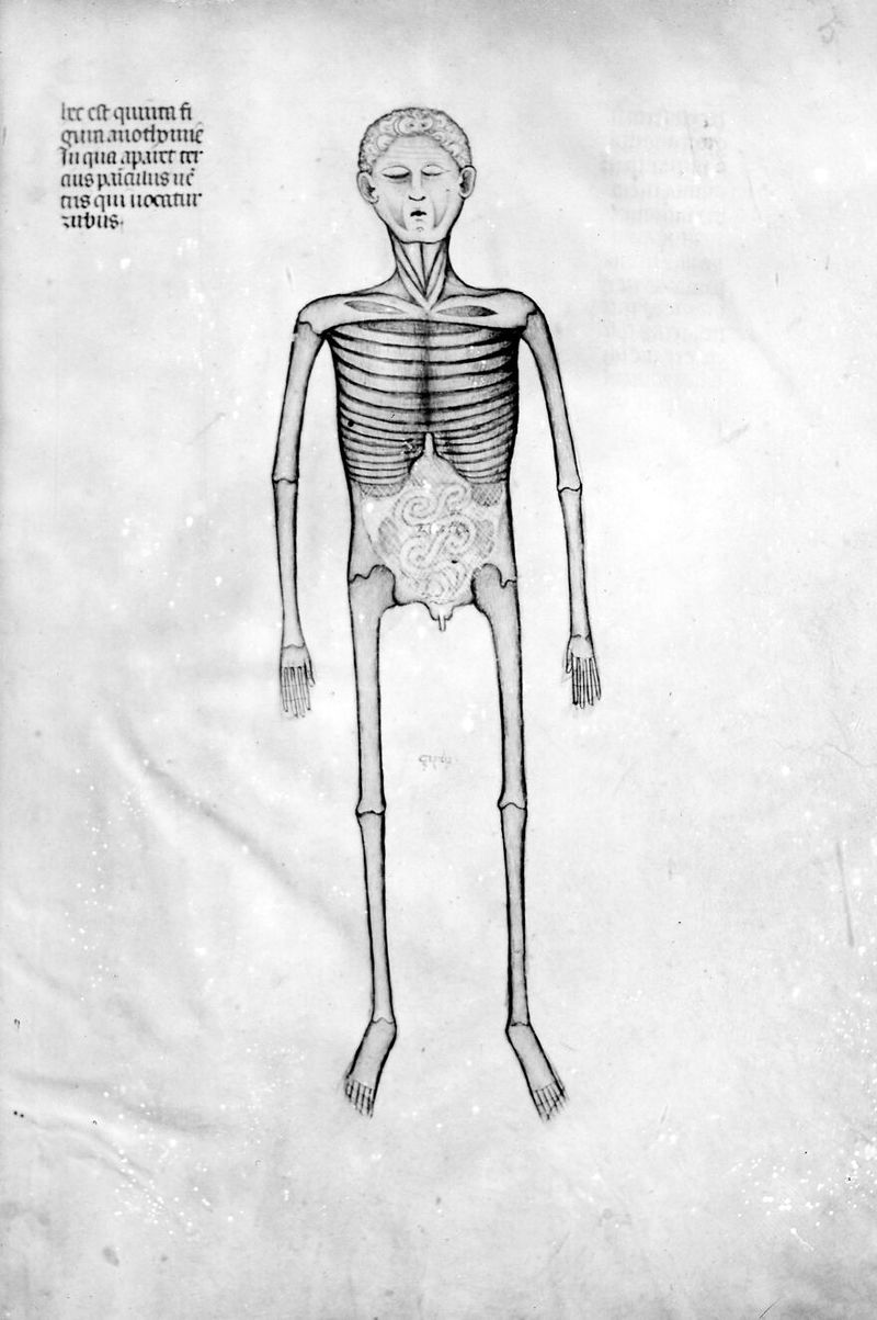 No text description is available for this image