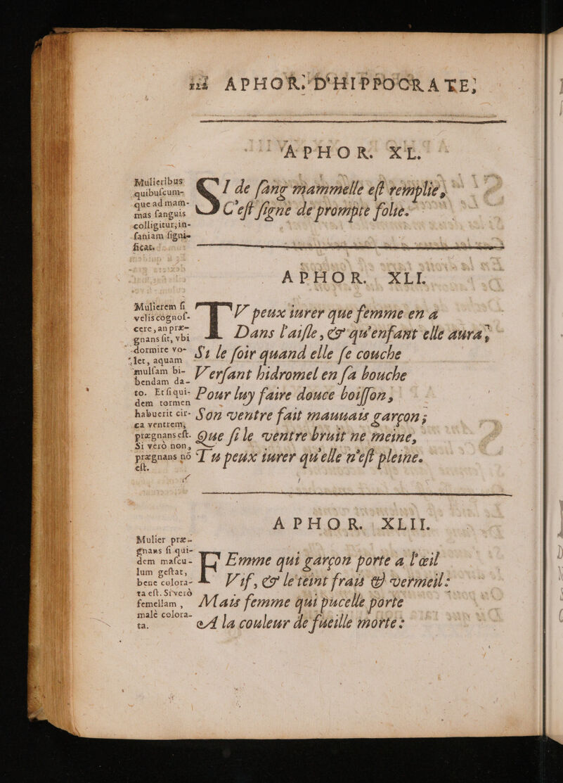 A PESAD EEO g^ EE, Mulieribus „ 1$ 1 * to + e) angulis fe € At 277: perti enn &amp; | P pi fo Vee faniam ſigni- heat. | pcm ALHOR ALT Mulierem f : | -vi not- : y peux inrer que femme en a cere, an præ- „ | i Dans laiſle, &amp; qu enfant elle aura, nans ſit, vbi meum 1 le foir quand elle fe couche let, aquam mulam bi- Weyfant hidromel en fa bouche bendam da- ro. kel qu Pour luy faire douce boiſſon, dem tormen habuerit cir- &amp; : : | : 5 care Son ventre fait WAUUAUS CAYCOR ; pregnanseft- Ozge file ventre bruit ne meine, Si vero non, — e Tu peux inrer qu'elle aef pleine. a t Mulier præ- gnans fi qui- 2 ? i 9 as TE ) 9t dem mas ) mine qui garçon porte a l'œil Es peii Vif, eg le‘teint frais e vermeil: femelam, Mats femme qui pucelle porte male colora- i A A la couleur de ‘fueille morte: