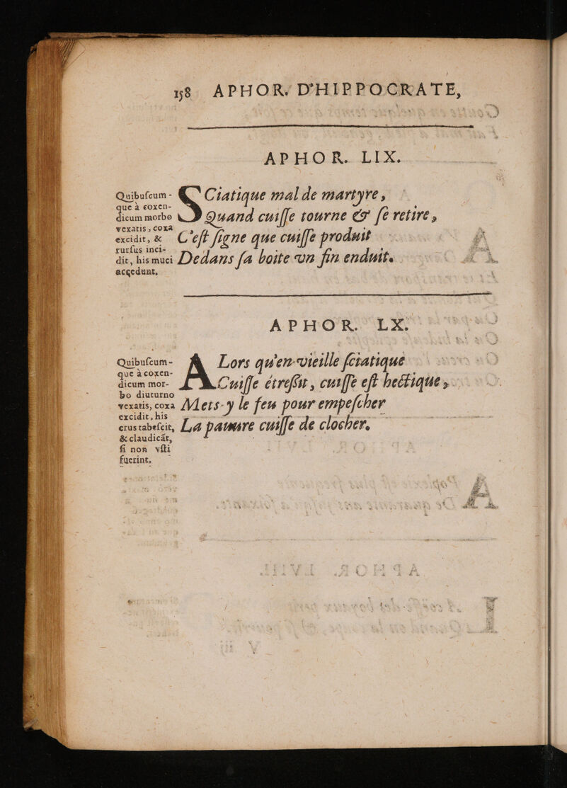 =- 58 APHOR. D'HIPPOCKATE, APHOR. LIX. Quibuteum- C` Ciatique mal de martyre, que à coxen- Es | dicum mobo LD Quand cui[[e tourne &amp; fe retire, vexatis, COXA C t fi ‘ d $ xcidit, &amp; 5 MEUM eft frgne que cutffe produi dic, hismuci Dedans fa boite un fin enduit. accedunt, APHOR. LX. Quibutum- À Lor: qu en vieille fctatique que à coxen- „ 5 | dicum mor- Cuiſſe étreffit , cuiſſe eft hectique, vexatis, coza Viets- Y le feu pour empefcher Y ,h! —— wit ; HE crus tabefcit, La paure cuiſſe de clocher, &amp; claudicat, E de fi non víli : fuerint.