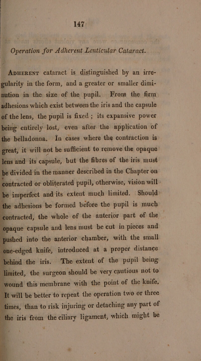 Operation for Adherent Lenticular Cataract. _Apuerenr cataract is distinguished by an irre- gularity in the form, and a greater or smaller dimi- nution in the size of the pupil. From the firm adhesions which exist between the iris and the capsule of the lens, the pupil is fixed ; its expansive power being entirely lost, even after the application of the belladonna. In cases where the contraction is great, it will not be sufficient to remove the opaque Tens and its open: but the fibres of the iris must te divided in the manner described in the Chapter on ‘contracted or obliterated pupil, otherwise, vision will : be imperfect and its extent much limited. Should s adhesions be formed before the pupil is much contracted, the whole of the anterior part of the | “ot ne-edged knife, sities at a proper distance behi nd the iris. The extent of the pupil being Timited, the surgeon should be very cautious not to wound this membrane with the point of the knife. tt will be better to repeat the operation two or three times, than to risk injuring or detaching any part of ‘the iris from the ciliary ligament, which might be