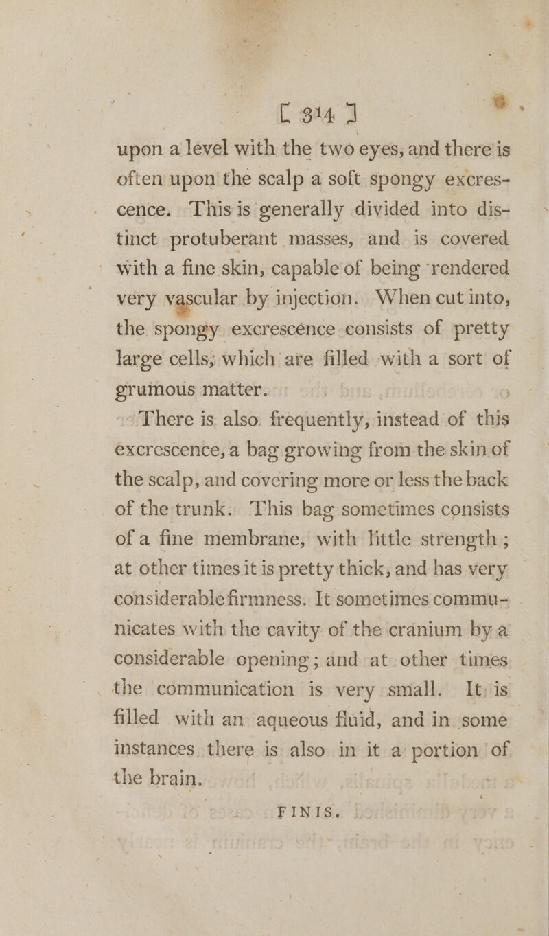 [3147 +: upon a level with the two eyes, and there is often upon the scalp a soft. spongy excres- cence. This is generally divided into dis- tinct protuberant masses, and is covered ’ with a fine skin, capable of being ‘rendered very vascular by injection. When cut into, the spongy excrescence consists of pretty large cells; which are filled with a sort of grumous matter. ‘There is also. frequently, instead of this excrescence, a bag growing from the skin of the scalp, and covering more or less the back of the trunk. This bag sometimes consists of a fine membrane, with little strength ; at other times it is pretty thick, and has very considerable firmness. It sometimes commu- nicates with the cavity of the cranium by a considerable opening ; and at other times — _ the communication is very small. It: is filled with an aqueous fluid, and in some instances there is also in it a portion of the brain. £2 UF INT: