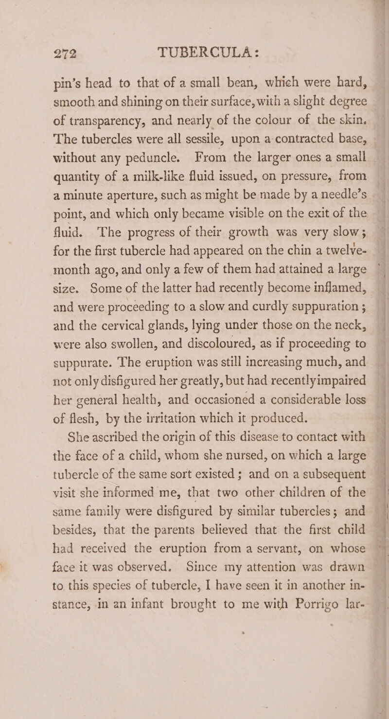 pin’s head to that of a small bean, which were hard, smooth and shining on their surface, with a slight degree of transparency, and nearly of the colour of the skin. The tubercles were all sessile, upon a contracted base, without any peduncle. From the larger ones a small quantity of a milk-like fluid issued, on pressure, from a minute aperture, such as’‘might be made by a needle’s point, and which only became visible on the exit of the fluid. The progress of their growth was very slow; for the first tubercle had appeared on the chin a twelve- month ago, and only a few of them had attained a large size. Some of the latter had recently become inflamed, and were proceeding to a slow and curdly suppuration ; and the cervical glands, lying under those on the neck, were also swollen, and discoloured, as if proceeding to suppurate. The eruption was still increasing much, and not only disfigured her greatly, but had recentlyimpaired her general health, and occasioned a considerable loss of flesh, by the irritation which it produced. She ascribed the origin of this disease to contact with the face of a child, whom she nursed, on which a large tubercle of the same sort existed ; and on a subsequent visit she informed me, that two other children of the same family were disfigured by similar tubercles; and besides, that the parents believed that the first child had received the eruption from a servant, on whose face it was observed. Since my attention was drawn to. this species of tubercle, I have seen it in another in- stance, in an infant brought to me with Porrigo lar- te ati an ee eee