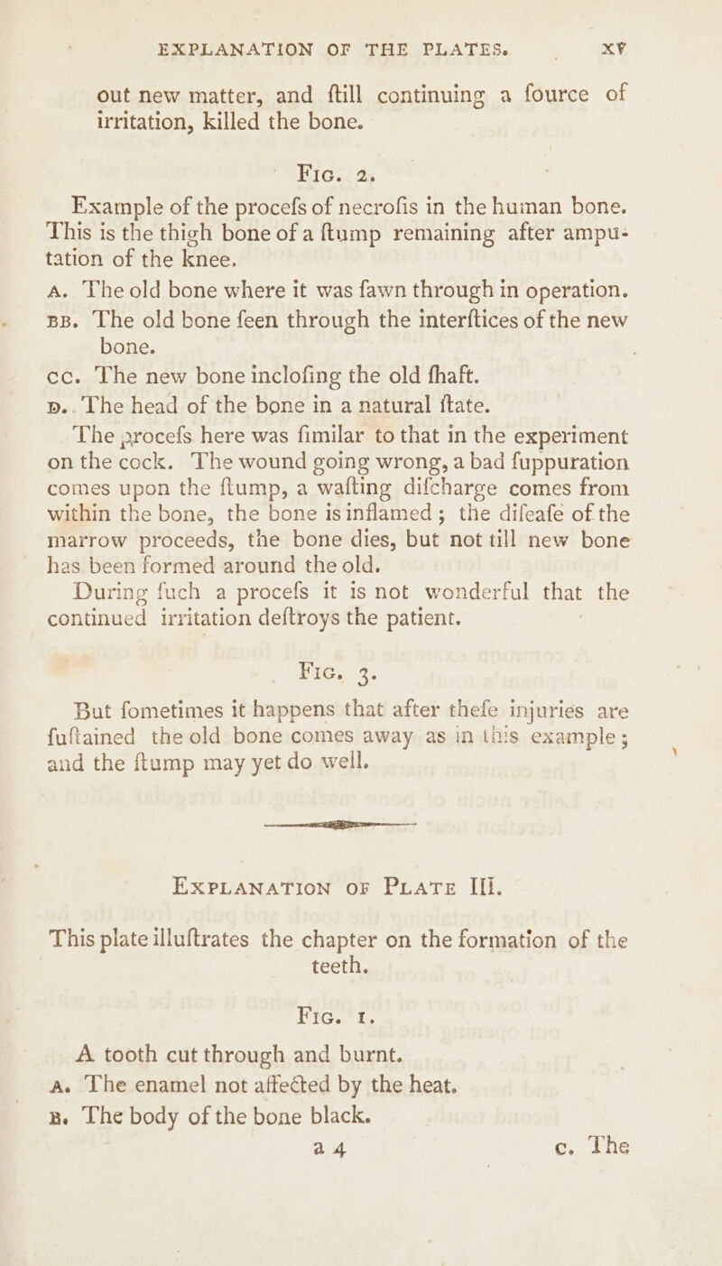 out new matter, and ftill continuing a fource of irritation, killed the bone. Fic. 2. Example of the procefs of necrofis in the human bone. This is the thigh bone of a ftump remaining after ampu- tation of the knee. A. Theold bone where it was fawn through in operation. BB. The old bone feen through the interftices of the new bone. cc. The new bone inclofing the old fhaft. p.. The head of the bone in a natural {tate. The procefs here was fimilar to that in the experiment on the cock. The wound going wrong, a bad fuppuration comes upon the flump, a walling difcharge comes from within the bone, the bone isinflamed; the difeafe of the marrow proceeds, the bone dies, but not till new bone has been formed around the old. During fuch a procefs it is not wonderful that the continued irr itation deftroys the patient. Fic. 3. But fometimes it happens that after thefe injuries are fuftained the old bone comes away as in this example and the {tump may yet do well. EXPLANATION OF PLATE III. This plate illuftrates the chapter on the formation of the teeth. Hig. i. A tooth cut through and burnt. a. The enamel not affected by the heat. B. The body of the bone black. a 4 c. The