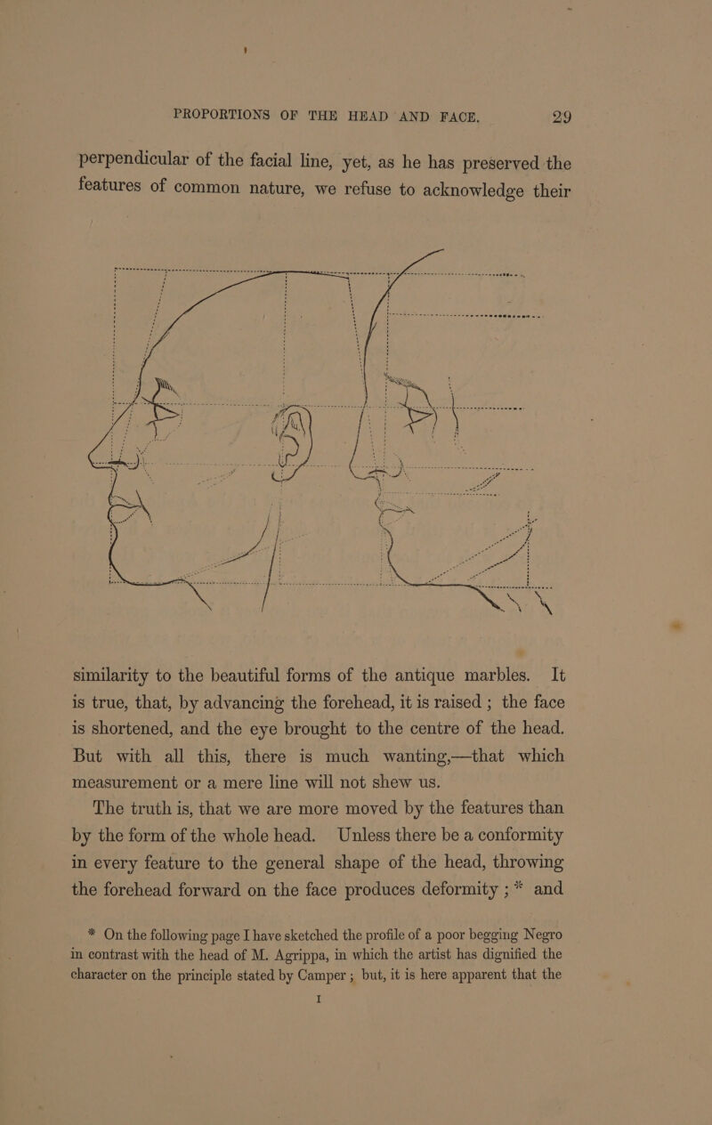 perpendicular of the facial line, yet, as he has preserved the features of common nature, we refuse to acknowledge their similarity to the beautiful forms of the antique marbles. It is true, that, by advancing the forehead, it is raised ; the face is shortened, and the eye brought to the centre of the head. But with all this, there is much wanting,—that which measurement or a mere line will not shew us. The truth is, that we are more moved by the features than by the form of the whole head. Unless there be a conformity in every feature to the general shape of the head, throwing the forehead forward on the face produces deformity ;* and * On the following page I have sketched the profile of a poor begging Negro in contrast with the head of M. Agrippa, in which the artist has dignified the character on the principle stated by Camper ; but, it is here apparent that the I