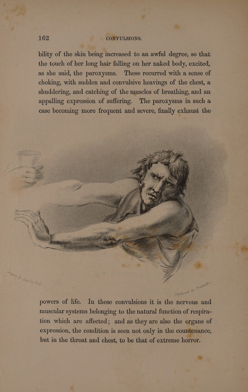 ay. 162 CONVULSIONS. bility of the skin being increased to an awful degree, so that the touch of her long hair falling on her naked body, excited, as she said, the paroxysms. These recurred with a sense of choking, with sudden and convulsive heavings of the chest, a shuddering, and catching of the muscles of breathing, and an appalling expression of suffering. The paroxysms in such a case becoming more frequent and severe, finally exhaust the