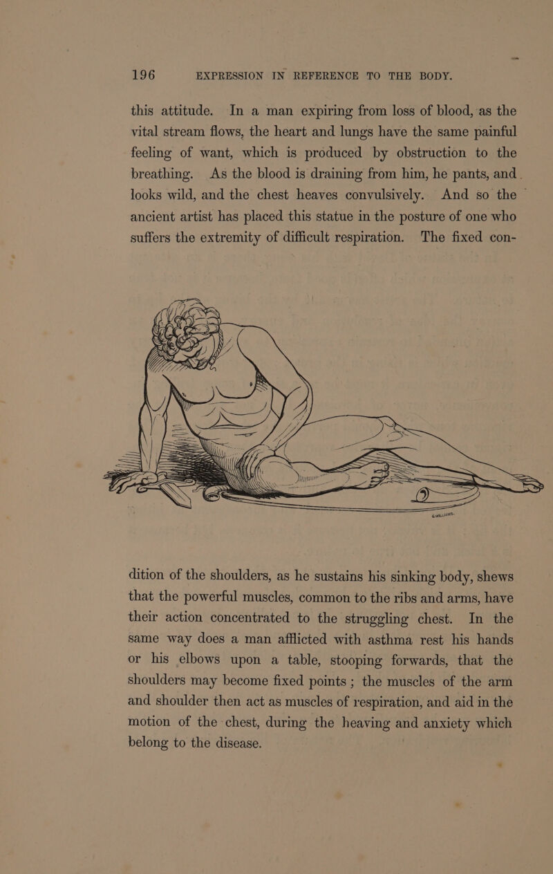 this attitude. In a man expiring from loss of blood, as the vital stream flows, the heart and lungs have the same painful feeling of want, which is produced by obstruction to the breathing. As the blood is draining from him, he pants, and. looks wild, and the chest heaves convulsively. And so the | ancient artist has placed this statue in the posture of one who suffers the extremity of difficult respiration. The fixed con- that the powerful muscles, common to the ribs and arms, have their action concentrated to the struggling chest. In the same way does a man afflicted with asthma rest his hands or his elbows upon a table, stooping forwards, that the shoulders may become fixed points ; the muscles of the arm and shoulder then act as muscles of respiration, and aid in the motion of the chest, during the heaving and anxiety which belong to the disease.