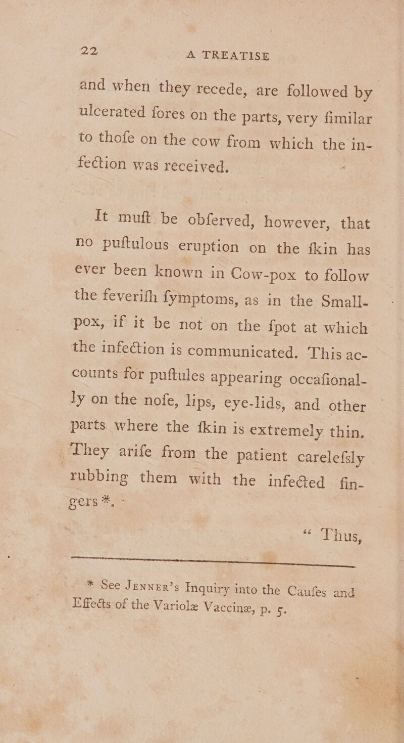 ulcerated fores on the parts, very fimilar to thofe on the cow from which the in- fection was received, It muft be obferved, however, that no puftulous eruption on the fkin has ever been known in Cow-pox to follow the feverifh fymptoms, as in the Small- pox, if it be not on the {pot at which the infection is communicated. This ac- counts for puftules appearing occafional- ly on the nofe, lips, eye-lids, and other parts where the {kin is extremely thin. _ They arife from the patient carelefsly | rubbing them with the infe@ed fin- gers ie 4 Thus, nee * See Jenner’s Inquiry into the Caufes and _ Effects of the Variole Vaccina, ese.