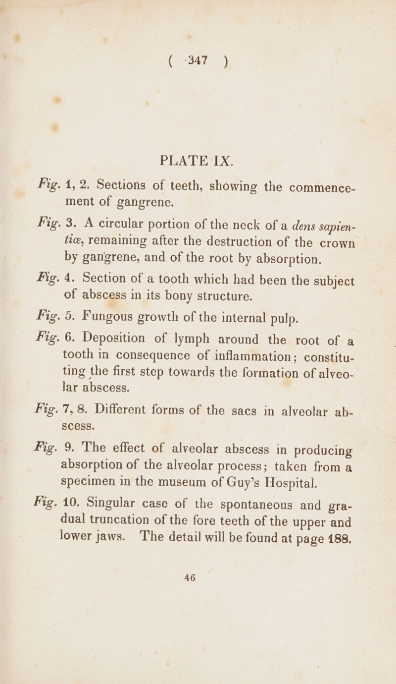 ( -347 ) PLATE IX. Fig. 1, 2. Sections of teeth, showing the commence- ment of gangrene. Fig. 3. A circular portion of the neck of a dens sapien- tie, remaining after the destruction of the crown by gangrene, and of the root by absorption. Hig. 4, Section of a tooth which had been the subject of abscess in its bony structure. fig. 5. Fungous growth of the internal pulp. Fig. 6. Deposition of lymph around the root of a tooth in consequence of inflammation; constitu- ting the first step towards the formation of alyeo- lar abscess. Fig. 7, 8. Different forms of the sacs in alveolar ab- Scess. fig. 9. The effect of alveolar abscess in producing absorption of the alveolar process; taken from a specimen in the museum of Guy’s Hospital. Fig. 10. Singular case of the spontaneous and gra- dual truncation of the fore teeth of the upper and lower jaws. The detail will be found at page 188, 46