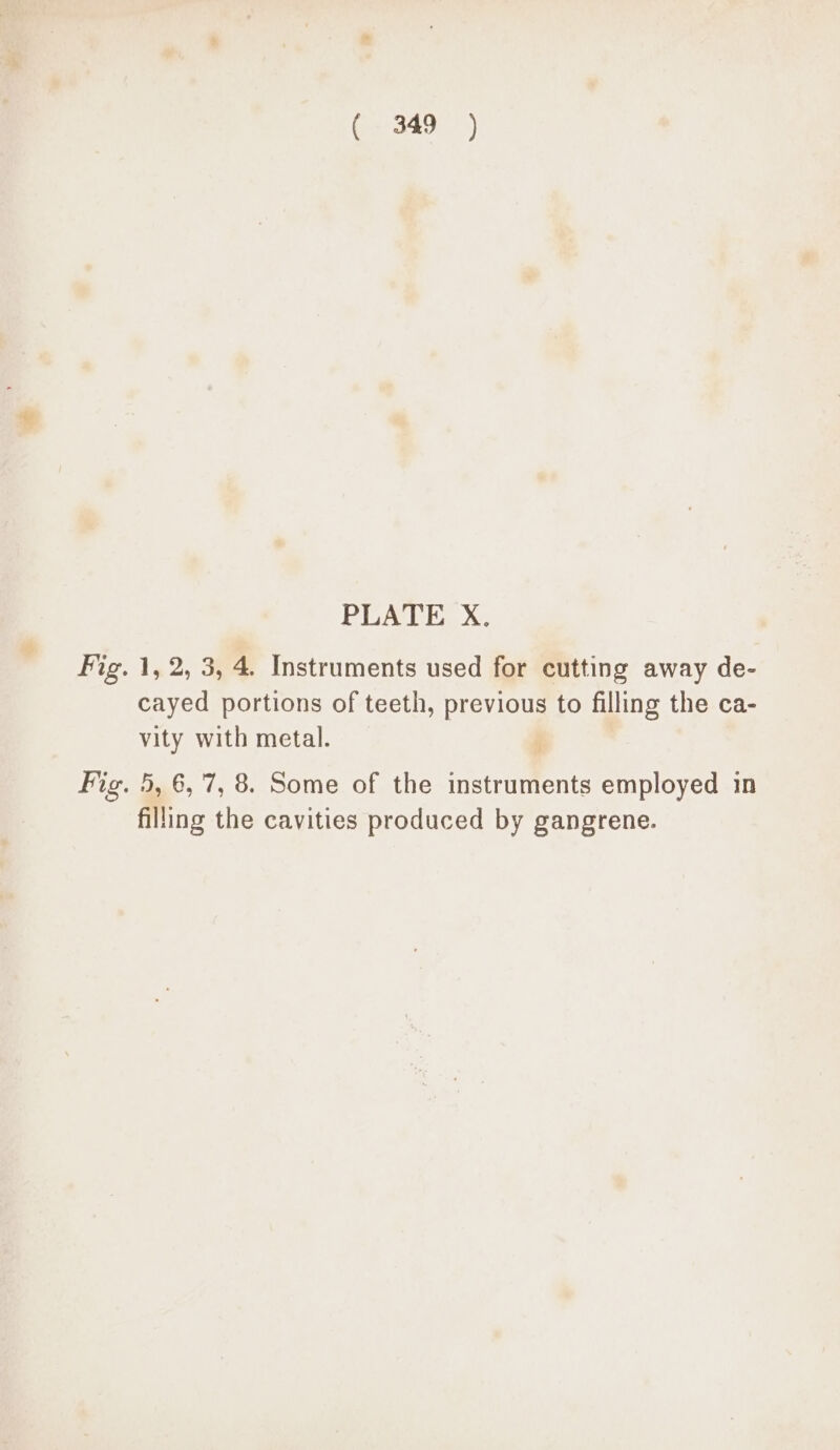 340) *) PLATE X. Fig. 1, 2, 3, 4. Instruments used for cutting away de- cayed portions of teeth, previous to filling the ca- vity with metal. Fig. 5, 6,7, 8. Some of the instruments employed in filling the cavities produced by gangrene.
