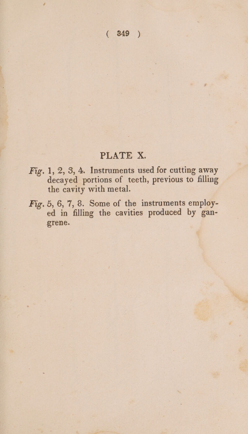 ( 849 ) PLATE X. Fig. 1, 2, 3, 4. Instruments used for cutting away decayed portions of teeth, previous to filling the cavity with metal. Fig. 5, 6,7, 8. Some of the instruments employ- ed in filling the cavities produced by gan- grene.