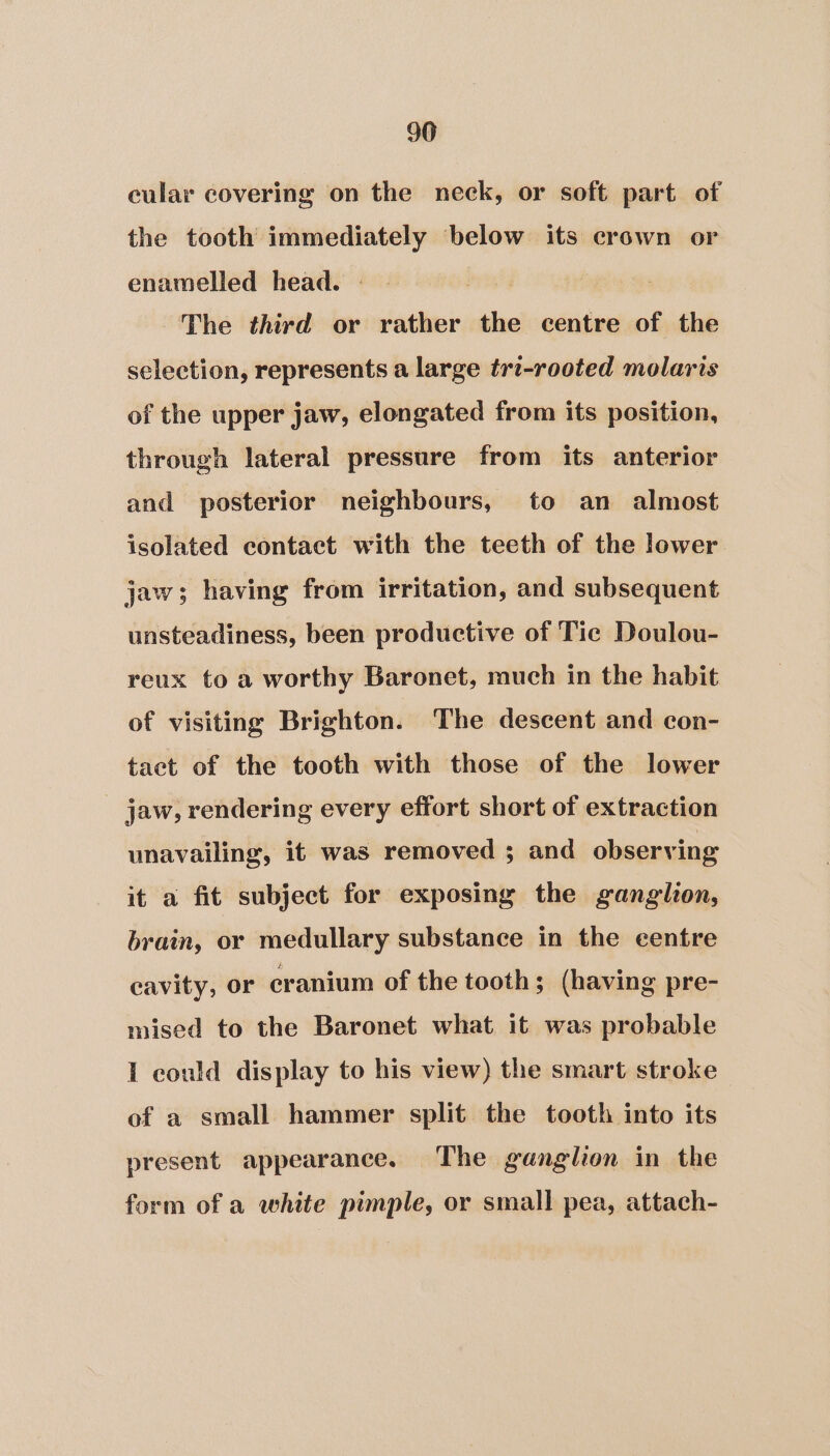 96 cular covering on the neck, or soft part of the tooth immediately below its crown or enamelled head. The third or rather the centre of the selection, represents a large trz-rooted molaris of the upper jaw, elongated from its position, through lateral pressure from its anterior and posterior neighbours, to an almost isolated contact with the teeth of the lower jaw; having from irritation, and subsequent unsteadiness, been productive of Tic Doulou- reux to a worthy Baronet, much in the habit of visiting Brighton. The descent and con- tact of the tooth with those of the lower _ jaw, rendering every effort short of extraction unavailing, it was removed ; and observing it a fit subject for exposing the ganglion, brain, or medullary substance in the eentre cavity, or cranium of the tooth; (having pre- mised to the Baronet what it was probable I could display to his view) the smart stroke of a small hammer split the tooth into its present appearance. The ganglion in the form of a white pimple, or small pea, attach-