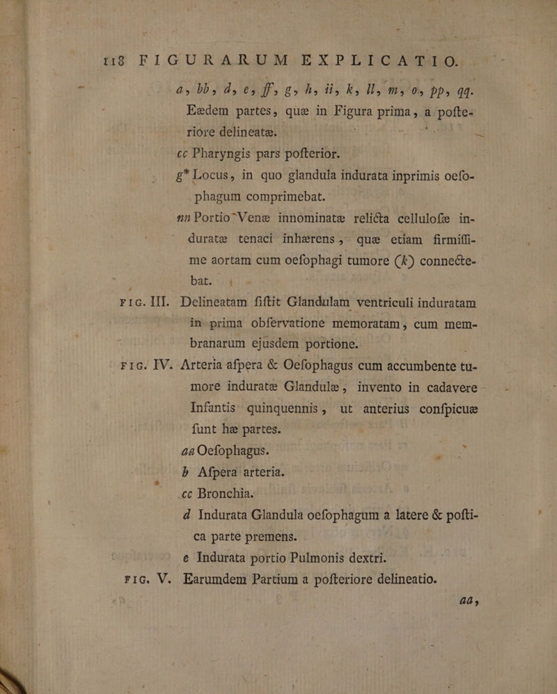 i * (3 & At bb. AS ORUE. Jh, 15 E, Uy MIS S 2b, qq. | Eedem partes, que in Figura Hripa se a pofte- rióre delineata. x cc Pharyngis pars pofterior. £* Locus, in quo glandula indurata inprimis oefo- .phagum comprimebat. £&nPortioVene innominate relicta denulofie in- durate tenaci inhzerens , qus etiam firmiffi- me aortam cum oefophagi tumore (&) connecte- j bàt. uM ric.lIL Delineatam fiftit Glandulam ventriculi induratam in prima obfervatione memoratam , cum mem- branarum ejusdem portione. ric. IV. Arteria afpera & Oefophagus cum d dunibencih tu- more indurate Glandule, invento in cadavere Infantis: quinquennis, ut anterius confpicue funt he partes. | : | 48 Oefophagus. ; (n b Afpera arteria. «t Bronchia. d Indurata Glandula PELA a latere & pofti- | ca parte premens. e Indurata portio Pulmonis dextri. ric. V. Earumdem Partium a pofteriore delineatio. 44,