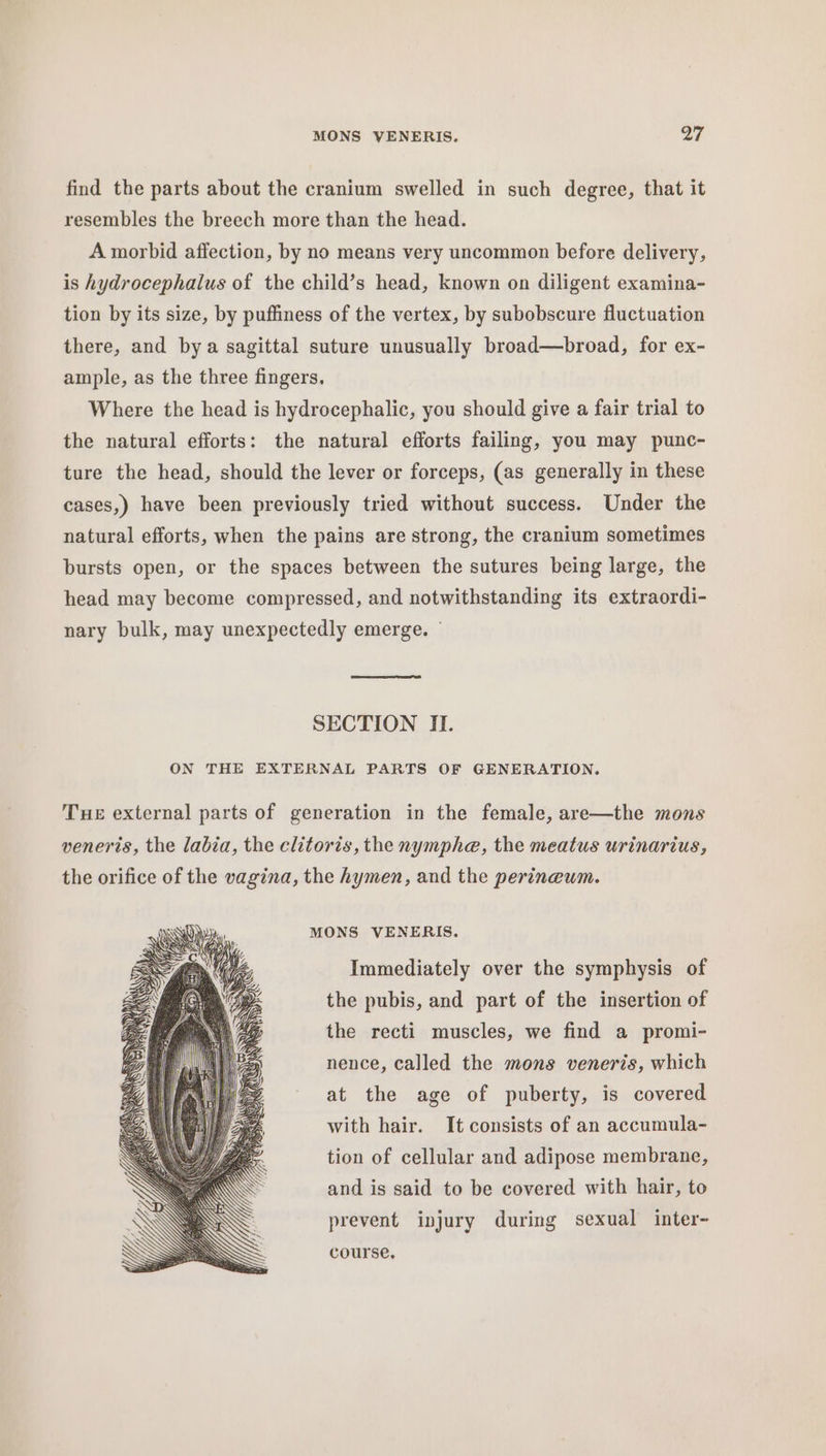 find the parts about the cranium swelled in such degree, that it resembles the breech more than the head. A morbid affection, by no means very uncommon before delivery, is hydrocephalus of the child’s head, known on diligent examina- tion by its size, by puffiness of the vertex, by subobscure fluctuation there, and bya sagittal suture unusually broad—broad, for ex- ample, as the three fingers. Where the head is hydrocephalic, you should give a fair trial to the natural efforts: the natural efforts failing, you may punc- ture the head, should the lever or forceps, (as generally in these cases,) have been previously tried without success. Under the natural efforts, when the pains are strong, the cranium sometimes bursts open, or the spaces between the sutures being large, the head may become compressed, and notwithstanding its extraordi- nary bulk, may unexpectedly emerge. SECTION II. ON THE EXTERNAL PARTS OF GENERATION. Tue external parts of generation in the female, are—the mons veneris, the labia, the clitoris, the nymphe, the meatus urinarius, the orifice of the vagina, the hymen, and the perineum. MONS VENERIS. Immediately over the symphysis of the pubis, and part of the insertion of the recti muscles, we find a promi- nence, called the mons veneris, which at the age of puberty, is covered with hair. It consists of an accumula- tion of cellular and adipose membrane, and is said to be covered with hair, to prevent injury during sexual inter- course.