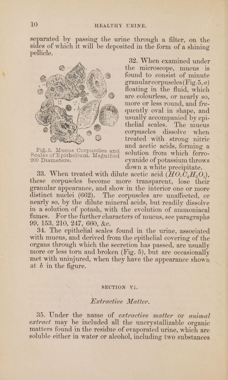 separated by passing the urine through a filter, on the sides of which it will be deposited in the form of a shining pellicle. 32. When examined under the microscope, mucus is found to consist of minute granular corpuscles (Fig.5, @) floating in the fluid, which are colourless, or nearly so, more or less round, and fre- quently oval in shape, and usually accompanied by epi- thelial scales. The mucus corpuscles dissolve when treated with strong nitric ieee Se ee and acetic acids, forming a Seales of Hpithelium. Magnified S°lution from which ferro- 200 Diameters. cyanide of potassium throws down a white precipitate. 33. When treated with dilute acetic acid (1O,0,H,0.), these corpuscles become more transparent, lose their granular appearance, and show in the interior one or more distinct nuclei (662). The corpuscles are unaffected, or nearly so, by the dilute mineral acids, but readily dissolve in a solution of potash, with the evolution of ammoniacal fumes. For the further characters of mucus, see paragraphs 99, 153, 210, 247, 660, &amp;e. 34. The epithelial scales found in the urine, associated with mucus, and derived from the epithelial covering of the organs through which the secretion has passed, are usually more or less torn and. broken (Fig. 5), but are occasionally met with uninjured, when they have the appearance shown at 6 in the figure. SECTION Vi. Lxtractive Matter. 35. Under the name of extractive matter or animal extract may be included all the uncrystallizable organic matters found in the residue of evaporated urine, which are soluble either in water or alcohol, including two substances