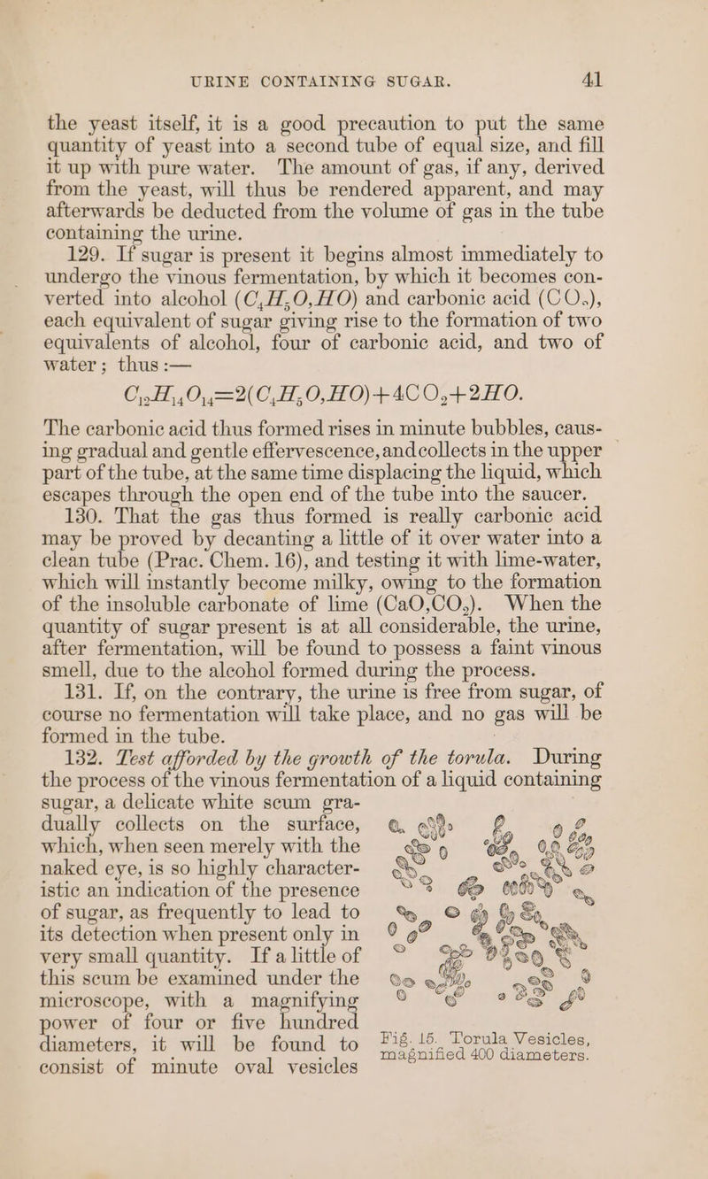 the yeast itself, it is a good precaution to put the same quantity of yeast into a second tube of equal size, and fill it up with pure water. The amount of gas, if any, derived from the yeast, will thus be rendered apparent, and may afterwards be deducted from the volume of gas in the tube containing the urine. 129. If sugar is present it begins almost immediately to undergo the vinous fermentation, by which it becomes con- verted into alcohol (C,H,O,HO) and carbonic acid (CO.), each equivalent of sugar giving rise to the formation of two equivalents of alcohol, four of carbonic acid, and two of water; thus :— O,.H,,0,,=2(C,H,0,H0)+4C0,4+2H0. The carbonic acid thus formed rises in minute bubbles, caus- _ ing gradual and gentle effervescence, and collects in the upper part of the tube, at the same time displacing the liquid, which escapes through the open end of the tube into the saucer. 130. That the gas thus formed is really carbonic acid may be proved by decanting a little of it over water into a clean tube (Prac. Chem. 16), and testing it with lime-water, which will instantly become milky, owing to the formation of the insoluble carbonate of lime (CaO,CO,). When the quantity of sugar present is at all considerable, the urine, after fermentation, will be found to possess a faint vinous smell, due to the alcohol formed during the process. 131. If, on the contrary, the urine is free from sugar, of course no fermentation will take place, and no gas will be formed in the tube. : 132. Test afforded by the growth of the torula. During the process of the vinous fermentation of a liquid containing sugar, a delicate white scum gra- dually collects on the surface, which, when seen merely with the naked eye, is so highly character- istic an indication of the presence of sugar, as frequently to lead to its detection when present only in very small quantity. Ifa little of this scum be examined under the microscope, with a magnifying power of four or five fuaiied diameters, it will be found to consist of minute oval vesicles Fig. 15. Torula Vesicles, magnified 400 diameters.