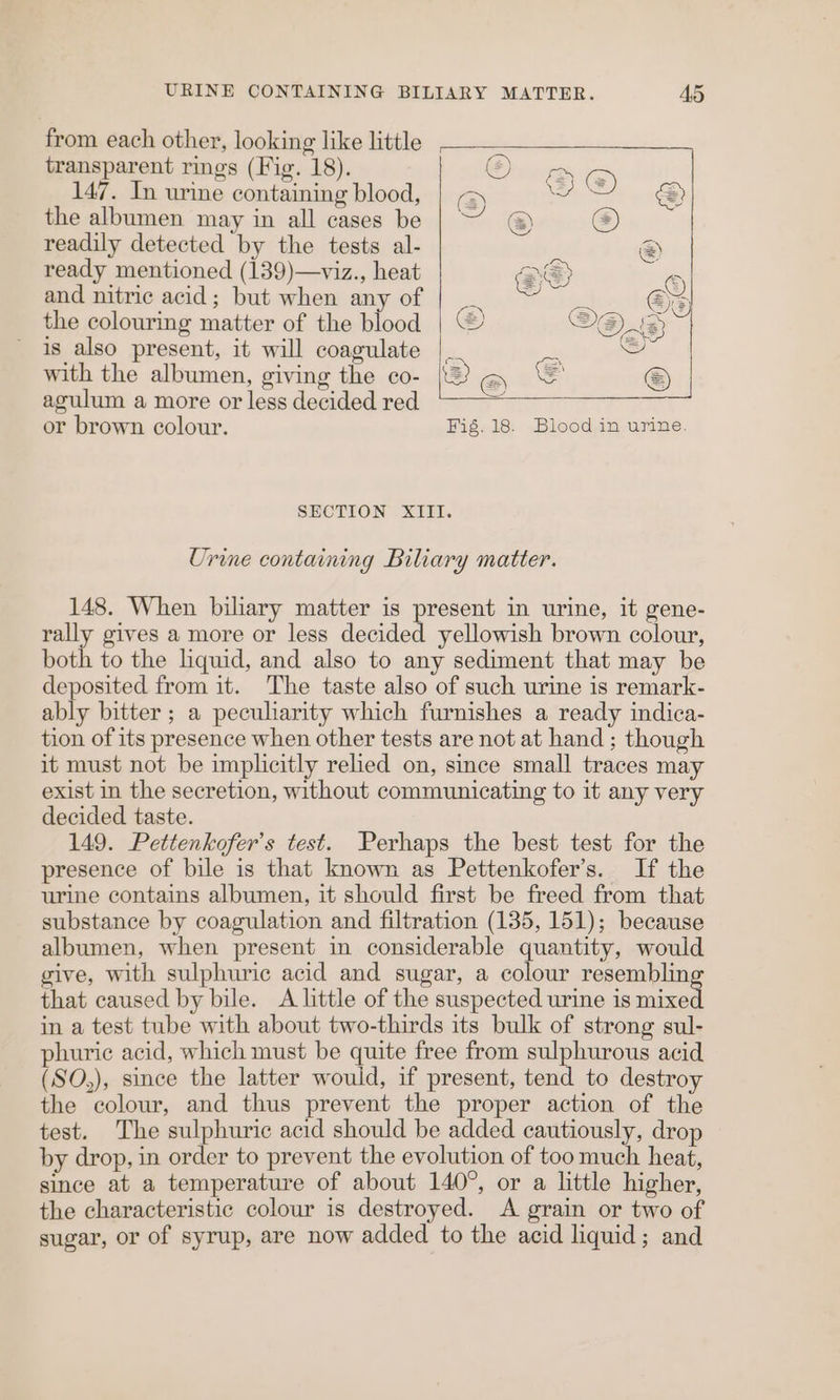 from each other, looking like little , transparent rings (Fig. 18). 147. In urine containing blood, the albumen may in all cases be readily detected by the tests al- ready mentioned (139)—viz., heat and nitric acid; but when any of the colouring matter of the blood is also present, it will coagulate with the albumen, giving the co- agulum a more or less decided red or brown colour. Fig. 18. Blood in urine. SECTION XIII. Urine containing Biliary matter. 148. When biliary matter is present in urine, it gene- rally gives a more or less decided yellowish brown colour, both to the liquid, and also to any sediment that may be deposited from it. The taste also of such urine is remark- ably bitter ; a peculiarity which furnishes a ready indica- tion of its presence when other tests are not at hand ; though it must not be implicitly relied on, since small traces may exist in the secretion, without communicating to it any very decided taste. 149. Pettenkofer’s test. Perhaps the best test for the presence of bile is that known as Pettenkofer’s. If the urine contains albumen, it should first be freed from that substance by coagulation and filtration (135, 151); because albumen, when present in considerable quantity, would give, with sulphuric acid and sugar, a colour resemblin that caused by bile. A little of the suspected urine is ae in a test tube with about two-thirds its bulk of strong sul- phuric acid, which must be quite free from sulphurous acid (SO,), since the latter wouid, if present, tend to destroy the colour, and thus prevent the proper action of the test. The sulphuric acid should be added cautiously, drop by drop, in order to prevent the evolution of too much heat, since at a temperature of about 140°, or a little higher, the characteristic colour is destroyed. <A grain or two of sugar, or of syrup, are now added to the acid liquid; and
