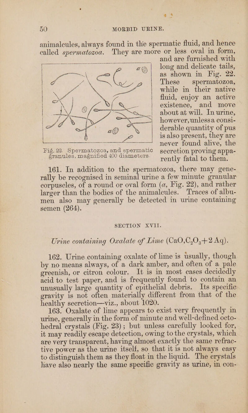 4 a ~ 50 MORBID URINE. animalcules, always found in the spermatic fluid, and hence called spermatozoa. They are more or less oval im form, and are furnished with long and delicate tails, as shown in Hig. 22. These spermatozoa, while in their native fluid, enjoy an active existence, and move about at will. In urine, however, unlessa consi- ~ derable quantity of pus is also present, they are never found alive, the Fig. 22. Spermatozoa, and spermatic retion vin s granules, magnified 400 diameters. ses LS fan rently fatal to them. 161. In addition to the spermatozoa, there may gene- rally be recognised in seminal urine a few minute granular corpuscles, of a round or oval form (a, Fig. 22), and rather larger than the bodies of the animalcules. ‘Traces of albu- men also may generally be detected in urine containing semen (264). SECTION XVII. Urine containing Oxalate of Lime (CaO,C,0,+2 Aq). 162. Urine containing oxalate of lime is usually, though by no means always, of a dark amber, and often of a pale greenish, or citron colour. It is in most cases decidedly acid to test paper, and is frequently found to contain an unusually large quantity of epithelial debris. Its specific gravity is not often materially different from that of the healthy secretion—viz., about 1020. 163. Oxalate of lime appears to exist very frequently in urine, generally in the form of minute and well-defined octo- hedral crystals (Fig. 23); but unless carefully looked for, it may readily escape detection, owing to the crystals, which are very transparent, having almost exactly the same refrac- tive power as the urine itself, so that it is not always easy to distinguish them as they float in the hquid. The crystals have also nearly the same specific gravity as urine, in con-