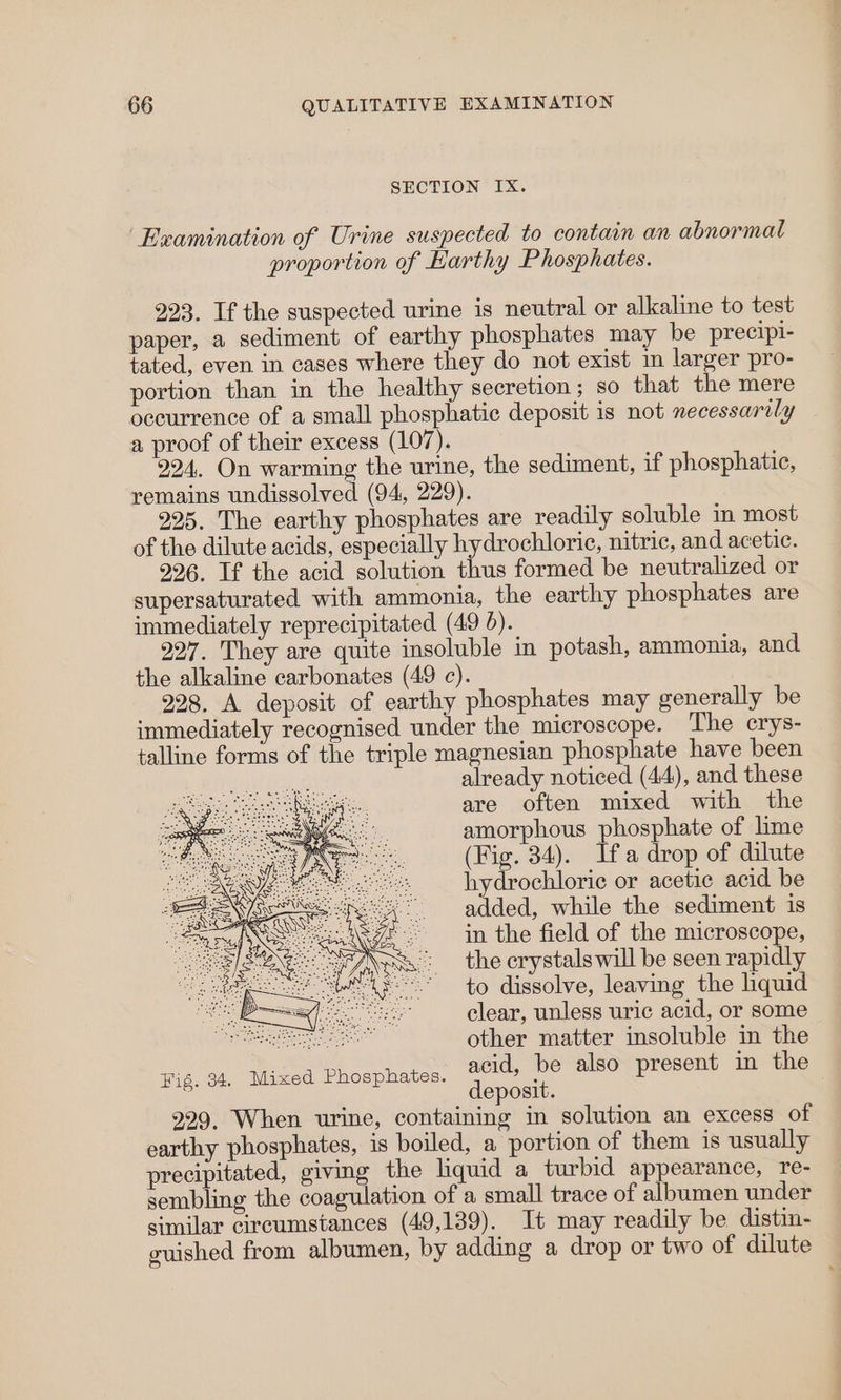 SECTION IX. Examination of Urine suspected to contain an abnormal proportion of Harthy Phosphates. 923. If the suspected urine is neutral or alkaline to test paper, a sediment of earthy phosphates may be precipi- tated, even in cases where they do not exist in larger pro- portion than in the healthy secretion; so that the mere occurrence of a small phosphatic deposit is not necessarily a proof of their excess (107). 924. On warming the urine, the sediment, if phosphatic, remains undissolved (94, 229). 995. The earthy phosphates are readily soluble in most of the dilute acids, especially hydrochloric, nitric, and acetic. 926. If the acid solution thus formed be neutralized or supersaturated with ammonia, the earthy phosphates are immediately reprecipitated (49 6). 227. They are quite insoluble in potash, ammonia, and the alkaline carbonates (49 c). 998, A deposit of earthy phosphates may generally be immediately recognised under the microscope. ‘The crys- talline forms of the triple magnesian phosphate have been already noticed (44), and these are often mixed with the amorphous phosphate of lime (Fig. 34). Ifa drop of dilute hydrochloric or acetic acid be added, while the sediment is in the field of the microscope, the crystals will be seen rapidly to dissolve, leaving the hquid clear, unless uric acid, or some eG other matter insoluble in the Fig. 34. Mixed Phosphates. acid, be also present in the deposit. 929, When urine, containing in solution an excess of earthy phosphates, is boiled, a portion of them is usually precipitated, giving the hquid a turbid appearance, re- sembling the coagulation of a small trace of albumen under similar circumstances (49,139). It may readily be distin- cuished from albumen, by adding a drop or two of dilute