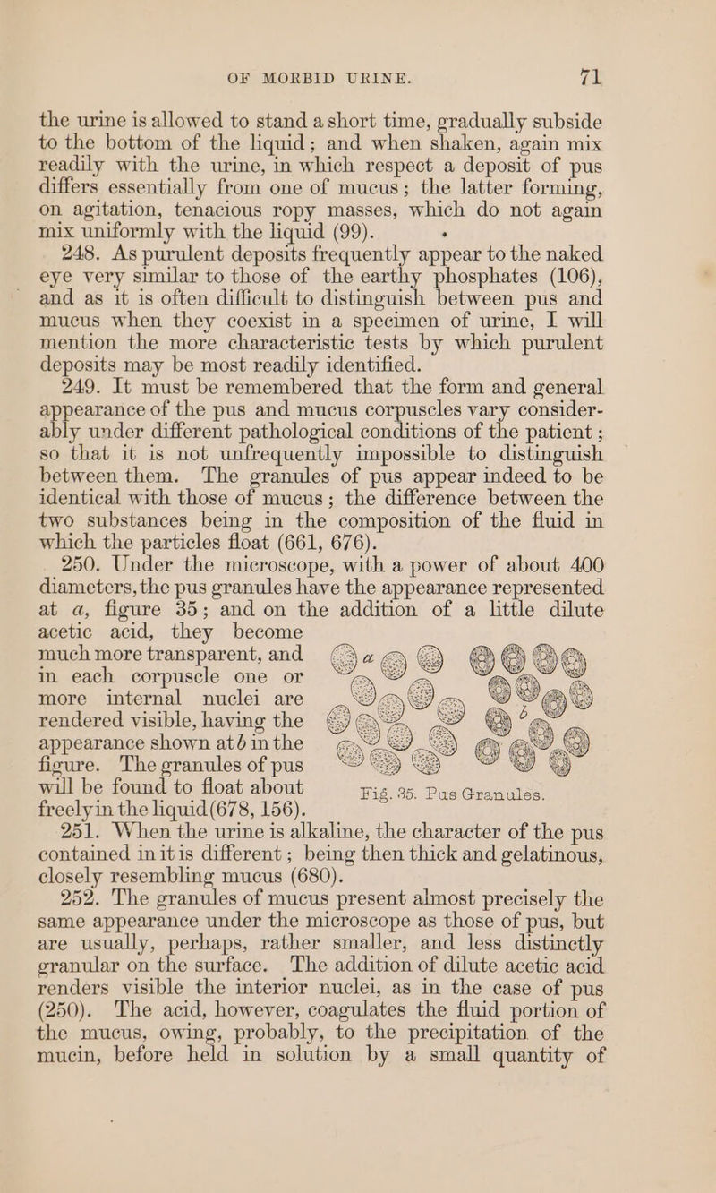 the urine is allowed to stand a short time, gradually subside to the bottom of the liquid; and when shaken, again mix readily with the urine, in which respect a deposit of pus differs essentially from one of mucus; the latter forming, on agitation, tenacious ropy masses, which do not again mix uniformly with the liquid (99). , 248. As purulent deposits frequently appear to the naked eye very similar to those of the earthy phosphates (106), and as it is often difficult to distinguish between pus and mucus when they coexist in a specimen of urine, I will mention the more characteristic tests by which purulent deposits may be most readily identified. 249. It must be remembered that the form and general appearance of the pus and mucus corpuscles vary consider- ably under different pathological conditions of the patient ; so that it is not unfrequently impossible to distinguish between them. The granules of pus appear indeed to be identical with those of mucus; the difference between the two substances being in the composition of the fluid in which the particles float (661, 676). 250. Under the microscope, with a power of about 400 diameters, the pus granules have the appearance represented at a, figure 35; and on the addition of a little dilute acetic acid, they become much more transparent, and in each corpuscle one or more internal nuclei are rendered visible, having the appearance shown até in the ficure. The granules of pus 9 Ss wil be found to float about Higise. Pus: Geanuies freelyin the liquid(678, 156). 251. When the urine is alkaline, the character of the pus contained in itis different ; being then thick and gelatinous, closely resembling mucus (680). 252. The granules of mucus present almost precisely the same appearance under the microscope as those of pus, but are usually, perhaps, rather smaller, and less distinctly granular on the surface. The addition of dilute acetic acid renders visible the interior nuclei, as in the case of pus (250). The acid, however, coagulates the fluid portion of the mucus, owing, probably, to the precipitation of the mucin, before held in solution by a small quantity of