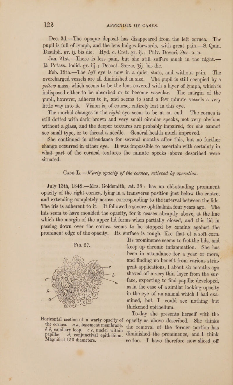 Dec. 3d.—The opaque deposit has disappeared from the left cornea. The pupil is full of lymph, and the lens bulges forwards, with great pain.—S. Quin. Disulph. gr. ij. bis die. Hyd. c. Cret. gr. ij.; Pulv. Doveri, Oss. o. n. Jan. 21st.—There is less pain, but she still suffers much in the night.— I® Potass. Iodid. gr. i1j.; Decoct. Sarze, 3ij. bis die. Feb. 18th.—The lef eye is now in a quiet state, and without pain. The overcharged vessels are all diminished in size. ‘The pupil is still occupied by a yellow mass, which seems to be the lens covered with a layer of lymph, which is indisposed either to be absorbed or to become vascular. The margin of the pupil, however, adheres to it, and seems to send a few minute vessels a very little way into it. Vision is, of course, entirely lost in this eye. The morbid changes in the right eye seem to be at an end. The cornea is still dotted with dark brown and very small circular specks, not very obvious without a glass, and the deeper textures are probably impaired, for she cannot see small type, or to thread a needle. General health much improved. She continued in attendance for several months after this, but no further change occurred in either eye. It was impossible to ascertain with certainty in what part of the corneal textures the minute specks above described were situated. Casz L.—Warty opacity of the cornea, relieved by operation. July 13th, 1848.—Mrs. Goldsmith, et. 38: has an old-standing prominent opacity of the right cornea, lying in a transverse position just below the centre, and extending completely across, corresponding to the interval between the lids. The iris is adherent to it. It followed a severe ophthalmia four yearsago. The lids seem to have moulded the opacity, for it ceases abruptly above, at the line which the margin of the upper lid forms when partially closed, and this lid in passing down over the cornea seems to be stopped by coming against the prominent edge of the opacity. Its surface is rough, like that of a soft corn. Its prominence seems to fret the lids, and Fie. 37. keep up chronic inflammation. She has been in attendance for a year or more, and finding no benefit from various strin-— gent applications, I about six months ago shaved off a very thin layer from the sur- face, expecting to find papille developed, as in the case of a similar looking opacity in the eye of an animal which I had exa- mined, but I could see nothing but thickened epithelium. To-day she presents herself with the Horizontal section of a warty opacity of opacity as above described. She thinks “ cornea. ad, basement membrane. the removal of the former portion has » capillary loop. c¢c, nuclei within |... papille. —d, conjunctival epithelium. diminished. the prominence, and I think Magnified 150 diameters. . so too. I have therefore now sliced off