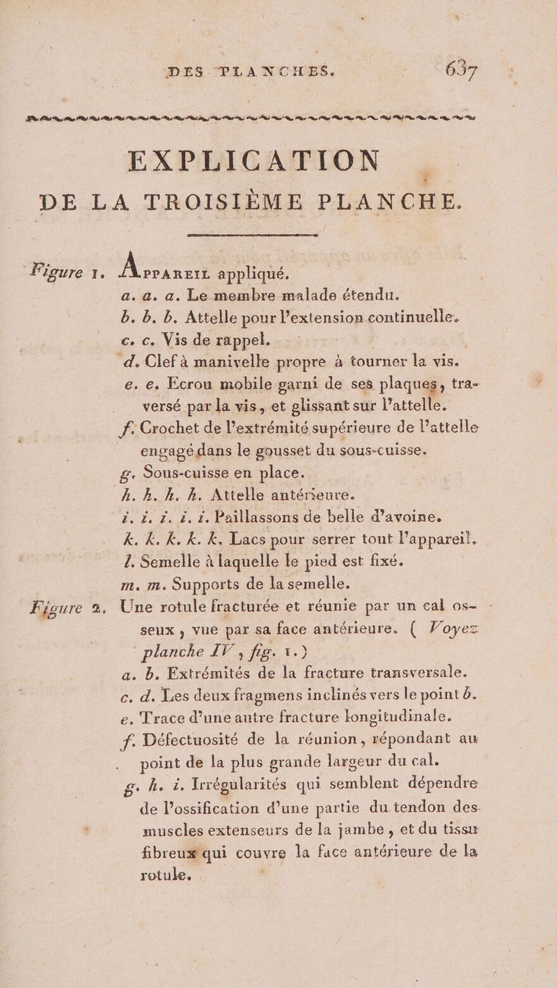 EXPLICATION Figure 2 € a. a, a. Le membre malade étendu. b. b. b. Attelle pour l'extension continuelle, c. ©. Vis de rappel. e. e. Ecrou mobile garni de ses plaques, tra- versé par la vis, et shssat sur l’attelle. engagé dans le pousset du sous-cuisse. g. Sous-cuisse en place. h. k. k. k. Attelle antérieure. ë. à, à. à. 1. Paillassons de belle d'avoine. k. k. K, k. &amp;. Lacs pour serrer tout l'appareil. 1. Semelle à laquelle Le pied est fixé. m. m. Supports de la semelle. Une rotule fracturée et réunie par un cal os- seux , vue par sa face antérieure. ( Voyez planche IV, fig. 1.) a. b. Extrémités de la fracture transversale. c. d. Les deux fragmens inclinés vers le point 6. e. Trace d’une autre fracture Hongitudinale. f. Défectuosité de la réunion, répondant au point de la plus grande largeur du cal. g. he à. Irrégularités qui semblent dépendre de l’ossification d’une partie du tendon des. muscles extenseurs de la jambe , et du tissu fibreux qui couvre la face antérieure de la