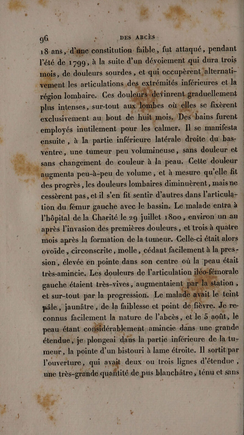 te _ Ld $ M 9 . ä ‘ . n | t j # Ver | EX \ \ * ne 7 ! , FR) Le | 2CS + 96 “ | DES ABCÈS 18-ans ;: ‘d'ane constitution: faible, fut attaqué , les l'été de 1799, à la suite d’un dévoiement qui dura trois mois, .de douleurs sourdes , et-qui occupèrent, ‘alternati- à nt les articulaHonas des extrémités inférieures et la eursrde finrent. graduellement Pl abent au bout Ft huit mois ” Débaine furent employés inutilement pour les calmer. Il se manifesta ensuite , à la partie inférieure latérale droite du',bas- | | “lombes où elles se fixèrent | | | | L ventre, une tumeur peu volumineuse ,. sans douleur .et _ sans changement de couleur à la peau. Cette douleur Maygmenta peu-à-peu de volume ; et à mesure qu elle fit des progrès , les douleurs lombaires diminuèrent , mais ne cessèrent pas, etil s’en fit sentir d’autres dans l’articula- | tion du fémur gauche avec le bassin. Le malade entra à | l'hôpital de la Charité le 29 juillet 1800 , environ un an après l'invasion des premières douleurs , et trois à quatre | mois après la formation de la tumeur. Celle-ci était alors | ovoïde, circonscrite, molle, cédant facilement à la pres- | sion , élevée en pointe dans son centre où la peau était | très-amincie. Les douleurs de l'articulation ne émorale PE Lu gauche étaient très-vives , augmentaient par das à et sur-tout par la progression. Le malade avait. pâle, jaunâtre , de la faiblesse.et point de 1 Je. re- connus facilement la nature de l’abcès,  le 5 août, le peau étant coifsidérablement amincie dans, une grande étendue , je’ plongeai dans la partie inférieure de latu- | meur, la pointe d’un bistouri à lame étroite. Il sortit: par l'ouverture, qui avait deux ou trois lignes détendue , | une tnès-grande quañtité de pus blanchätro, ténu et sans &amp; #, N # +