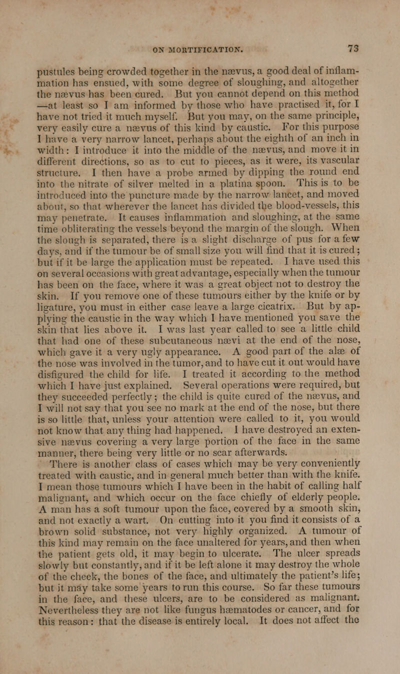 pustules being crowded together in the nevus, a good deal of inflam- mation has ensued, with some degree of sloughing, and altogether the nevus has been cured. But you cannot depend on this method —at least so I am informed by those who have practised it, for I have not tried it much myself. But you may, on the same principle, very easily cure a nevus of this kind by caustic. Jor this purpose I have a very narrow lancet, perhaps about the eighth of an inch in width: I introduce it into the middle of the nevus, and move it in different directions, so as to cut to pieces, as it were, its vascular structure. I then have a probe armed by dipping the round end into the nitrate of silver melted in a platina spoon. This is to be introduced into the puncture made by the narrow lancet, and moved about, so that wherever the lancet has divided the blood-vessels, this may penetrate. It causes inflammation and sloughing, at the same time obliterating the vessels beyond the margin of the slough. When the slough is separated, there isa slight discharge of pus for a few days, and if the tumour be of small size you will find that it is cured ; but if it be large the application must be repeated. I have used this on several occasions with great advantage, especially when the tumour has been on the face, where it was a great object not to destroy the skin. If you remove one of these tumours either by the knife or by ligature, you must in either case Jeave a large cicatrix. But by ap- plying the caustic in the way which I have mentioned you save the skin that lies above it. I was last year called to see a little child that had one of these subcutaneous nevi at the end of the nose, which gave it a very ugly appearance. A good part of the ale of the nose was involved in the tumor, and to have cut it out would have disfigured the child for life. I treated it according to the method which I have just explained. Several operations were required, but they succeeded perfectly ; the child is quite cured of the nevus, and I will not say that you see no mark at the end of the nose, but there is so little that, unless your attention were called to it, you would not know that any thing had happened. I have destroyed an exten- sive nevus covering a very large portion of the face in the same manner, there being very little or no scar afterwards. There is another class of cases which may be very conveniently treated with caustic, and in general much better than with the knife. I mean those tumours which I have been in the habit of calling half malignant, and which occur on the face chiefly of elderly people. A man has a soft tumour upon the face, covered by a smooth skin, and not exactly a wart. On cutting into it you find it consists of a brown solid substance, not very highly organized. A tumour of this kind may remain on the face unaltered for years, and then when the patient gets old, it may begin to ulcerate. The ulcer spreads slowly but constantly, and if it be left alone it may destroy the whole of the cheek, the bones of the face, and ultimately the patient’s life; but it may take some years torun this course. So far these tumours in the face, and these ulcers, are to be considered as malignant. Nevertheless they are not like fungus hematodes or cancer, and for this reason: that the disease is entirely local. It does not affect the